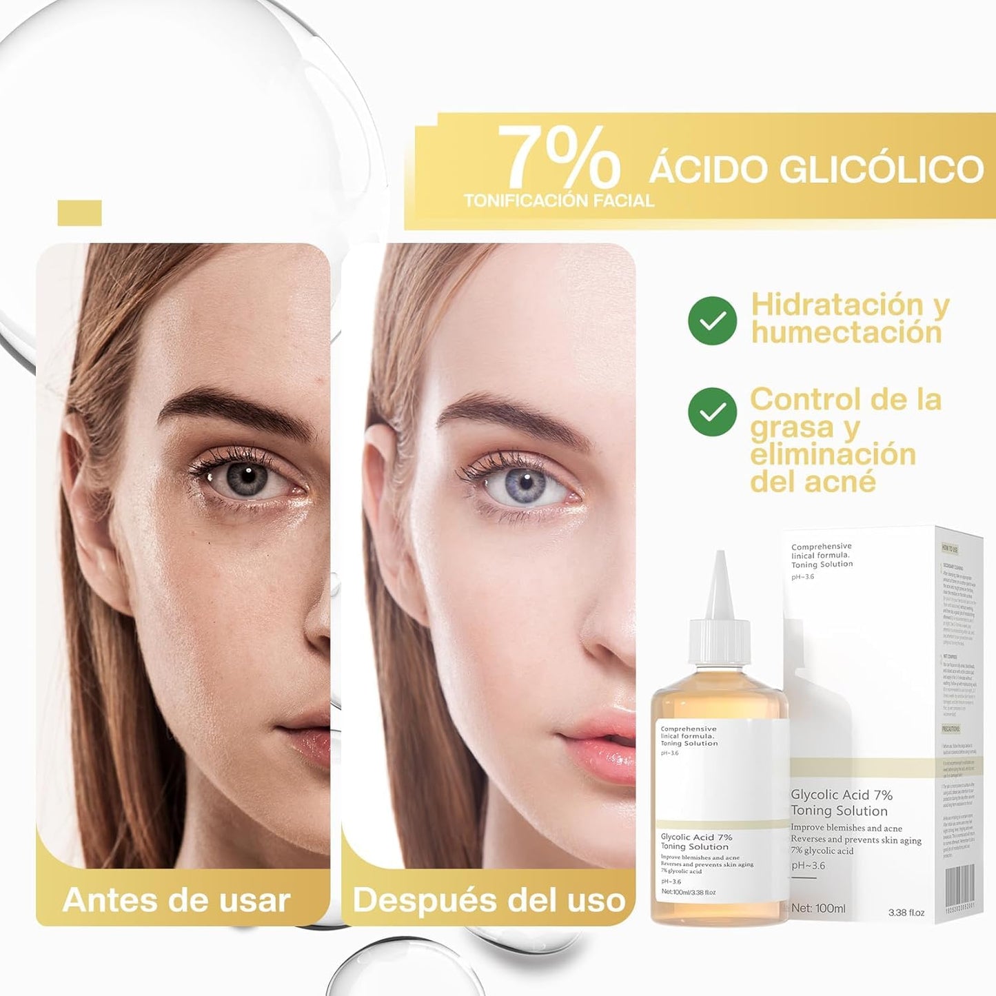 Tónico facial con Ácido Glicólico 7% - Exfoliante y Rejuvenecedor 100ml - Tratamiento para Manchas y Acné - Tonificante Antiacné y Despigmentante
