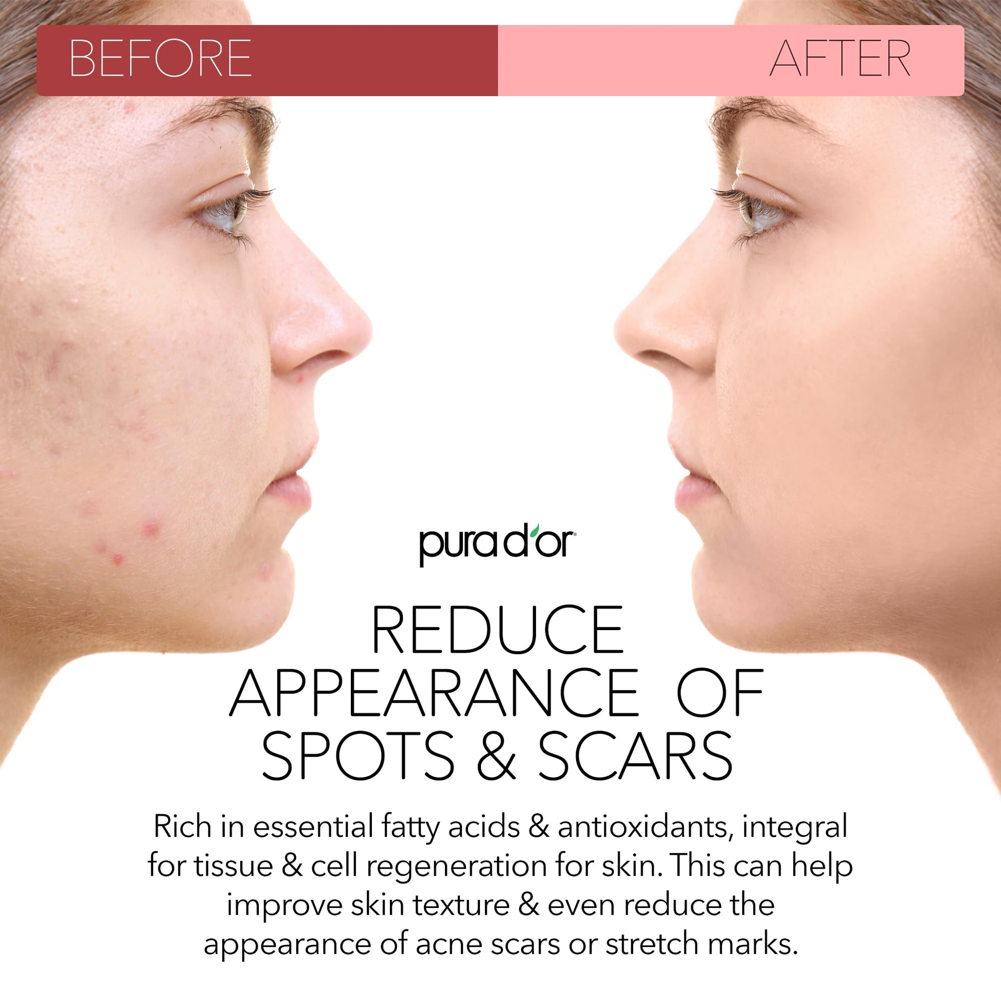 Aceite de Semilla de Rosa Mosqueta Orgánico Pura D'or 4 Onzas