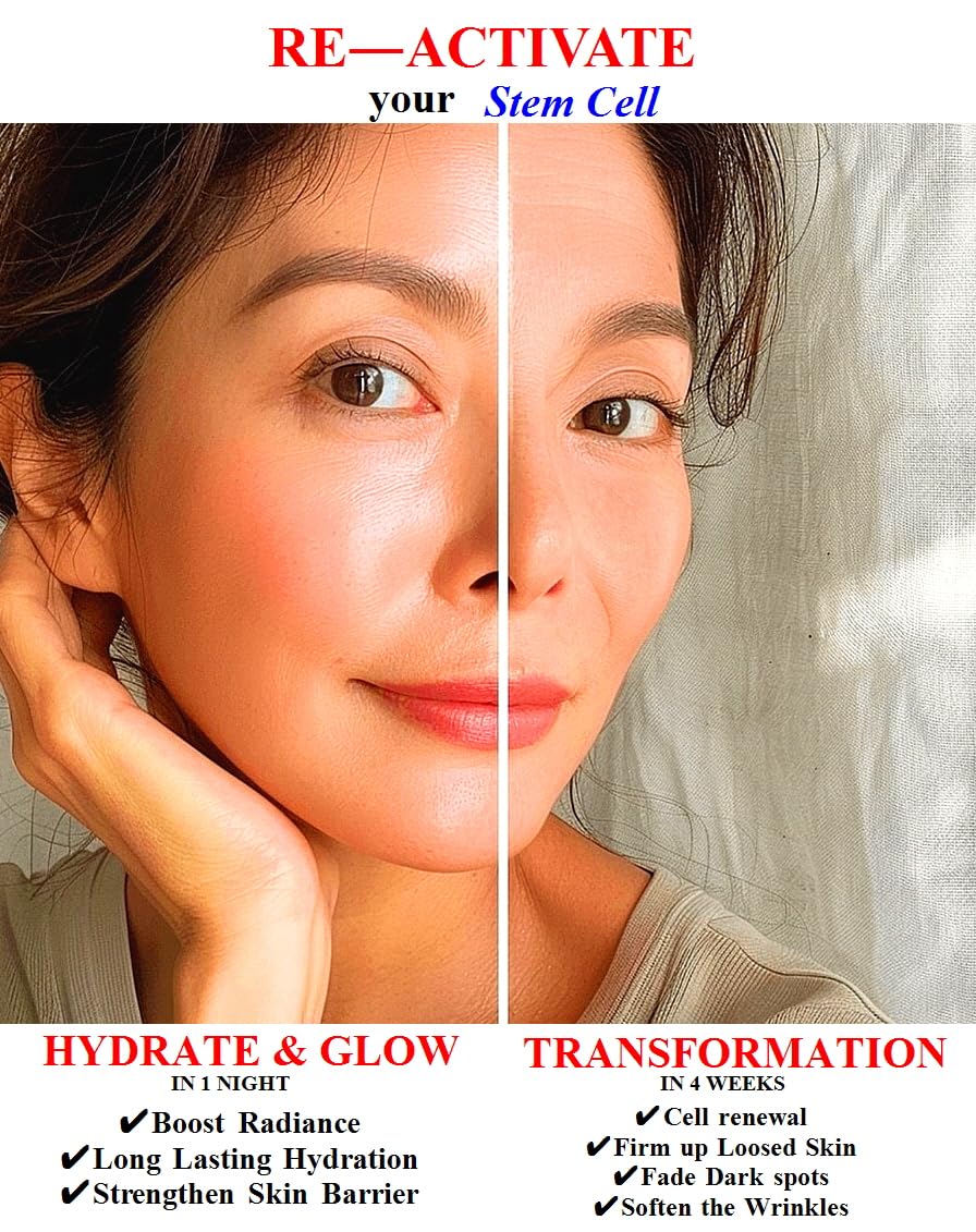 Suero regenerador excepcional: reafirma, da volumen y revitaliza con SCM, 5% de volufiline, colágeno T1 y PHA (30 ml, 1 oz)