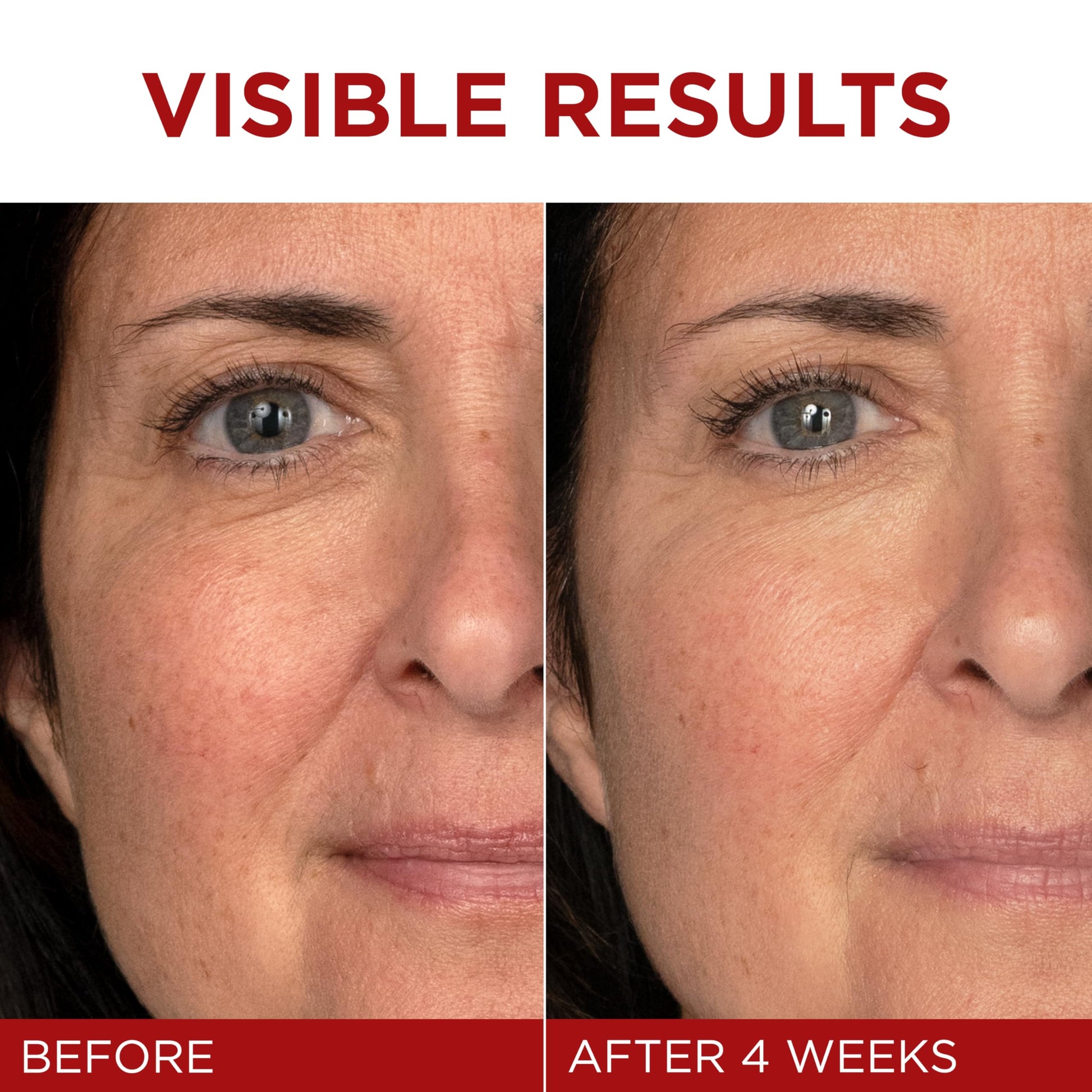 Face Moisturizer By L’Oreal Paris Skin Care I Revitalift Triple Power Fragrance Free Face Cream With Pro Retinol, Hyaluronic Acid & Vitamin C I 2.55 Oz