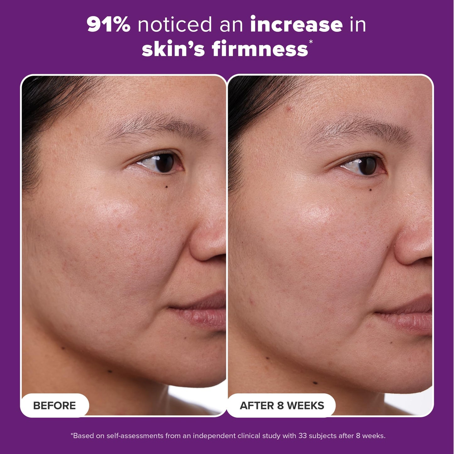 Tratamiento con Retinol 1% Paula's Choice Peptides y Vitamina C 1 oz para Arrugas Profundas