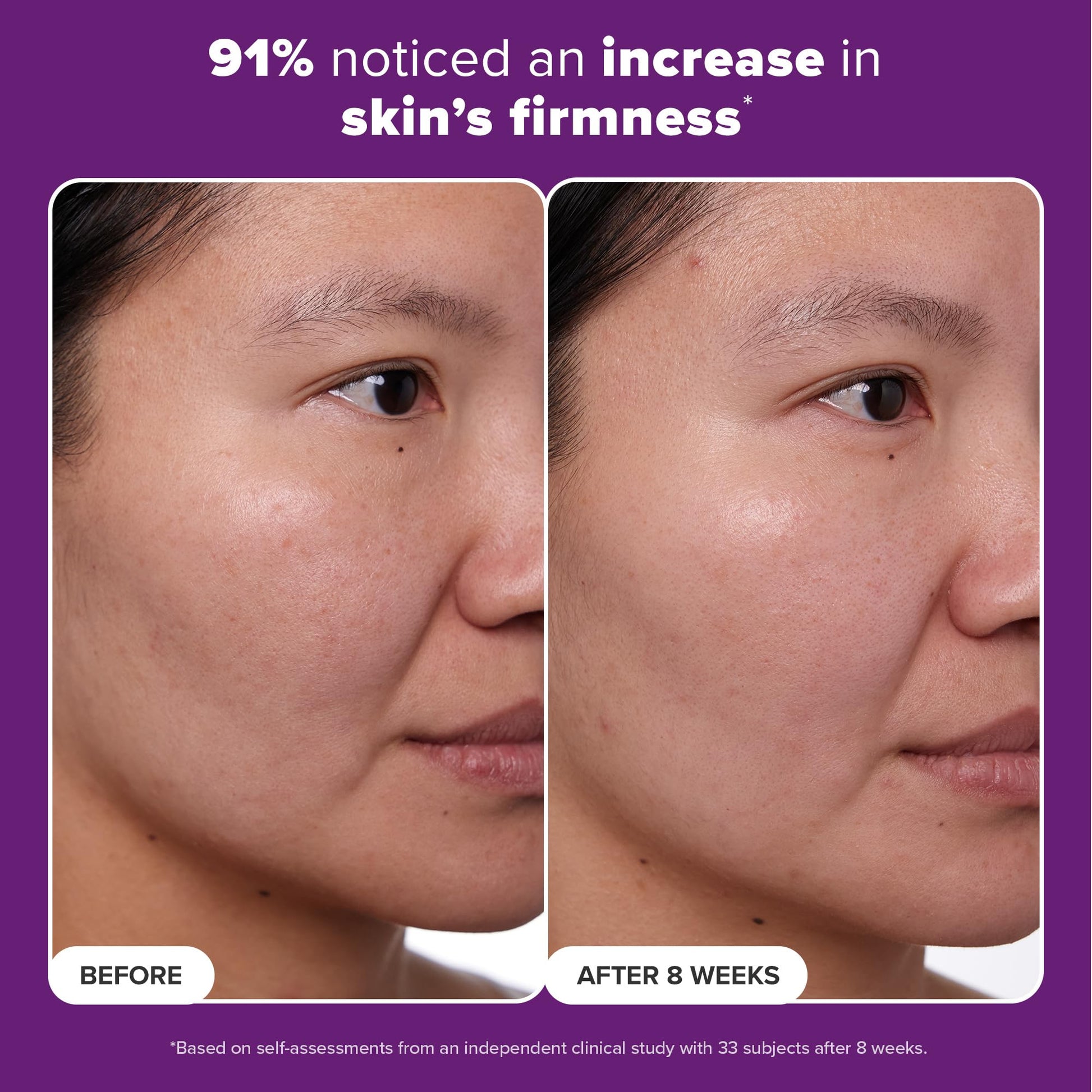 Tratamiento con Retinol 1% Paula's Choice Peptides y Vitamina C 1 oz para Arrugas Profundas