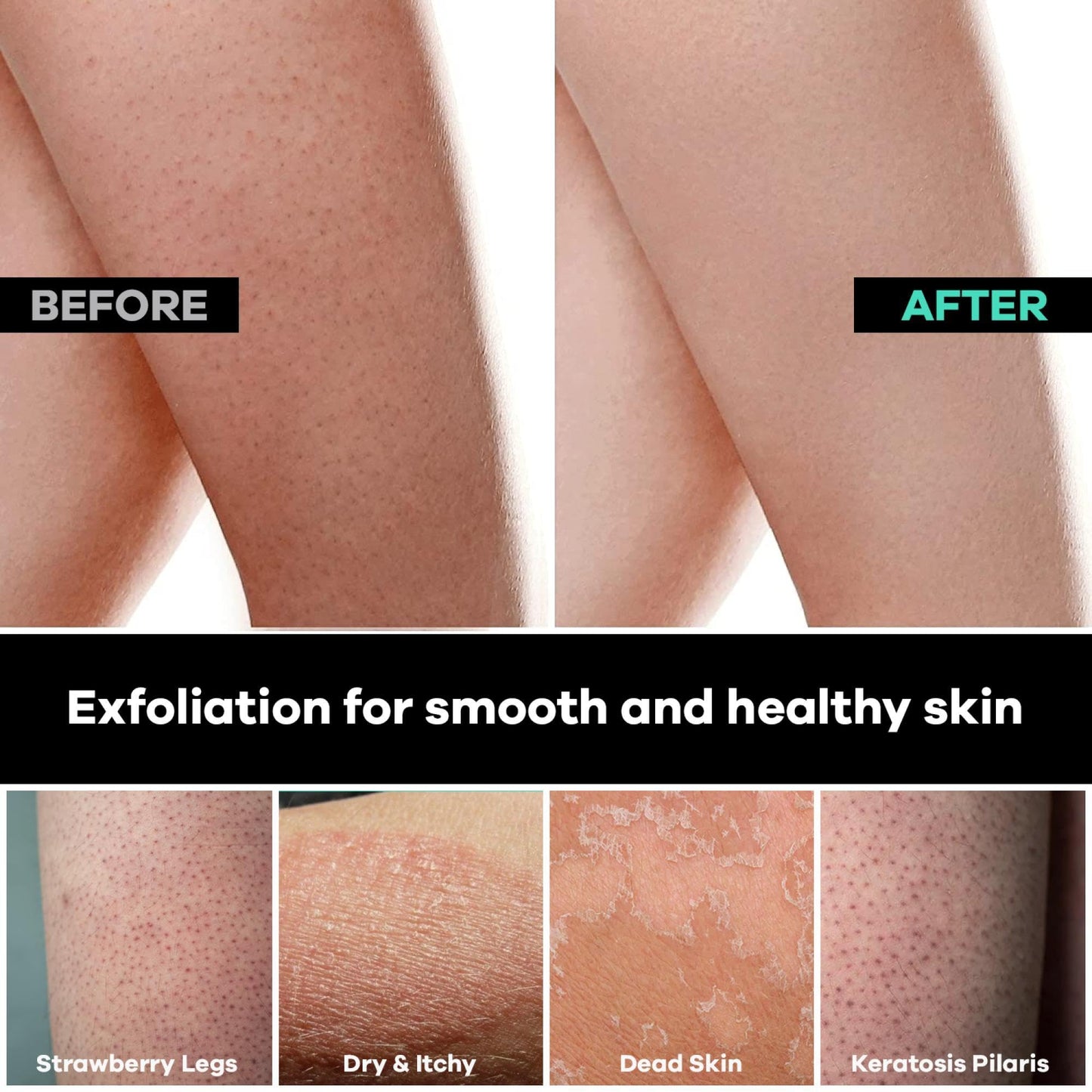 Dermasuri Deep Exfoliating Mitt Body Scrub - Exfoliating Glove Body Scrubber & Skin Cleanser - Body Scrub Gloves for Women & Men - Skin Exfoliator for Body Tool Remover of Dead & Dry Skin Pack of 2