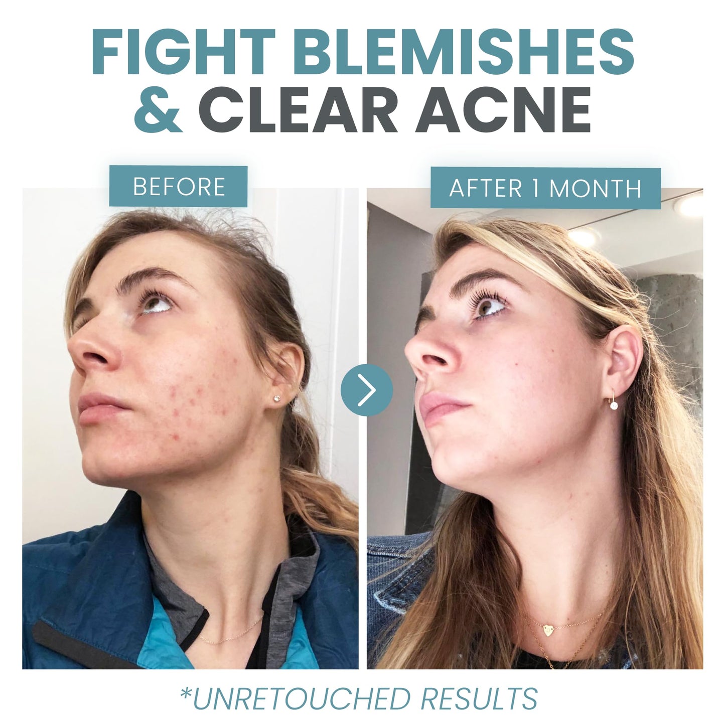 Vitamin C Serum Plus 2% Retinol, 3.5% Niacinamide, 5% Hyaluronic Acid, 2% Salicylic Acid, 10% MSM, 20% Vitamin C - Skin Clearing Serum - Anti-Aging Skin Repair, Supercharged Face Serum (1 oz)