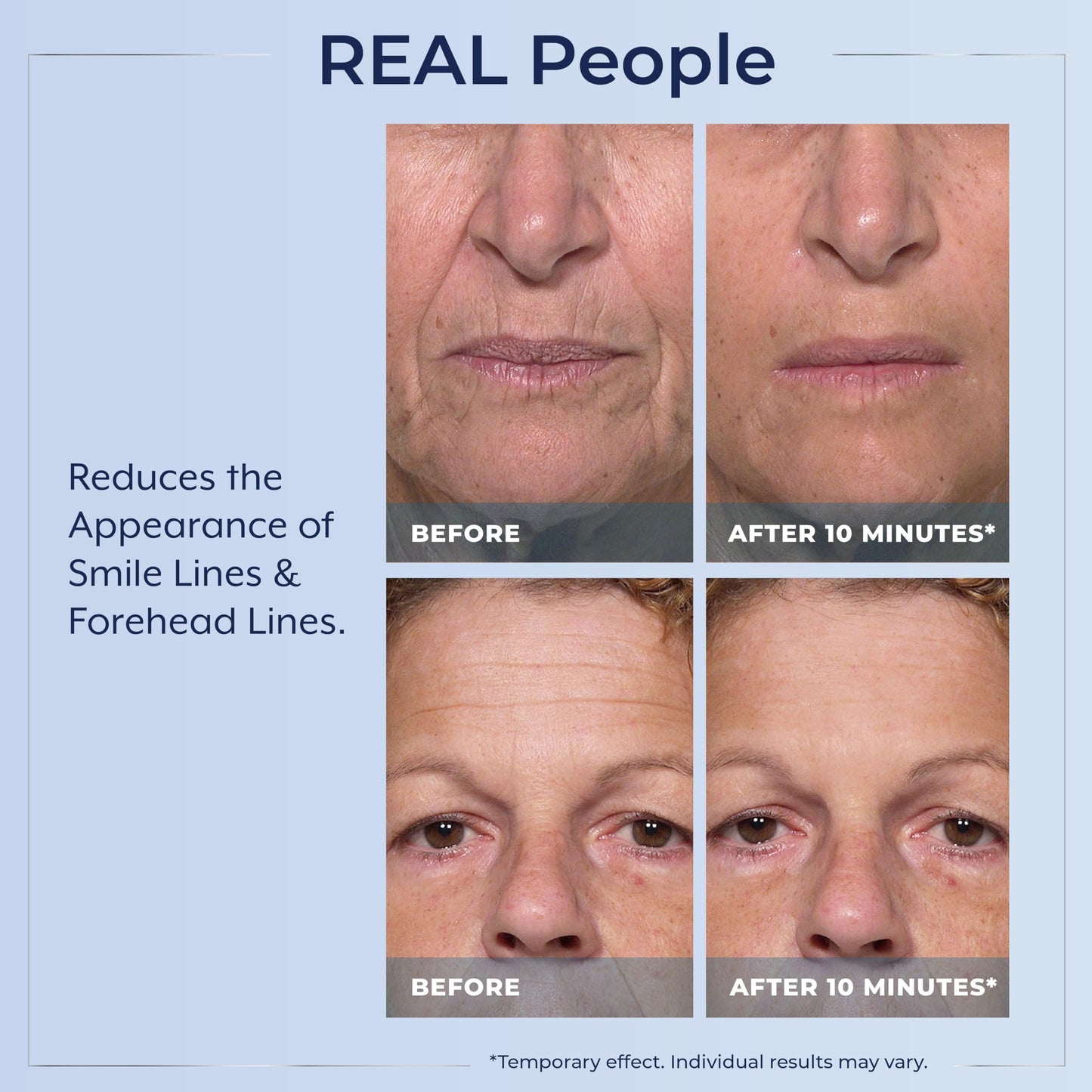 Suero Anti-Envejecimiento Plexaderm Avanzado con Minerales de Arcilla para Piel Rejuvenecida