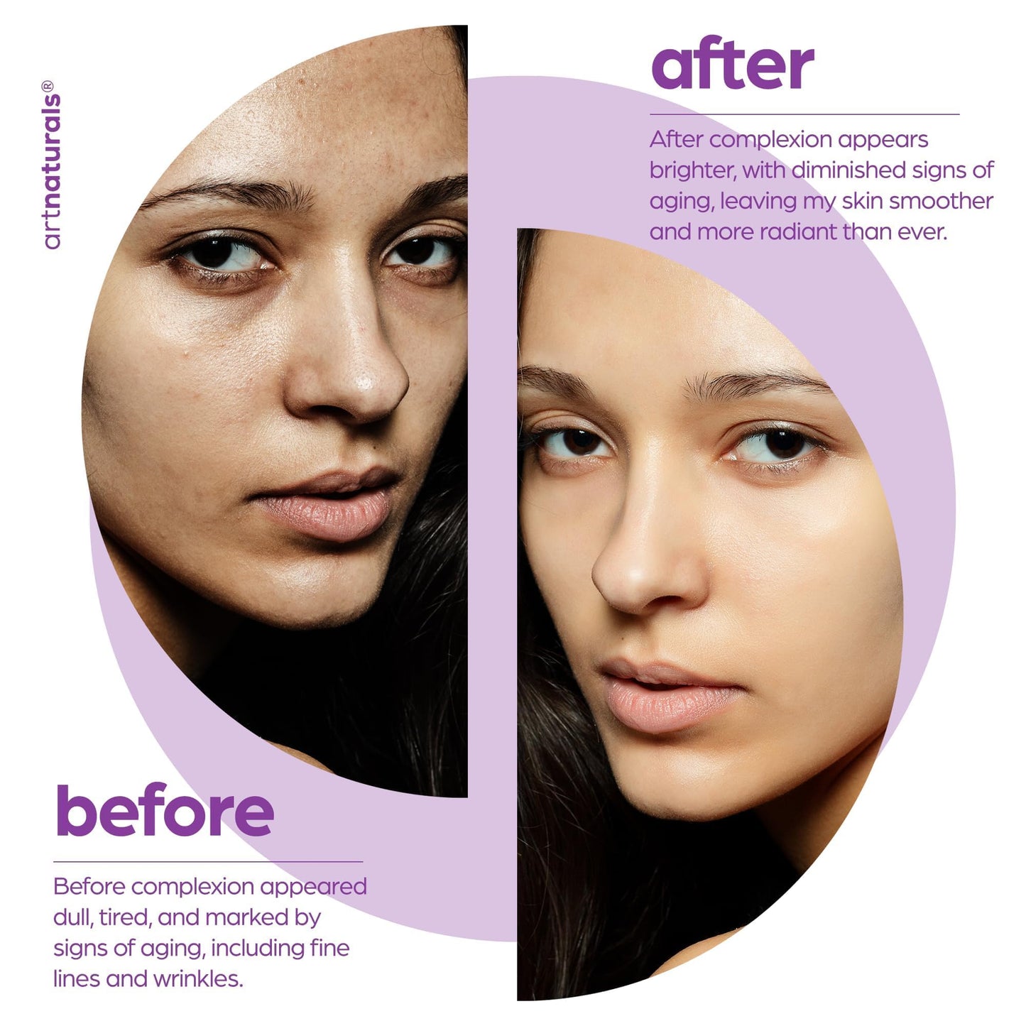 Art Naturals Suero de retinol mejorado 2,5% con 20% de vitamina C y ácido hialurónico 1 oz, el mejor suero antiarrugas y antienvejecimiento para rostro y piel sensible - Ingredientes orgánicos de fuerza clínica - Terapia nocturna de Art Naturals