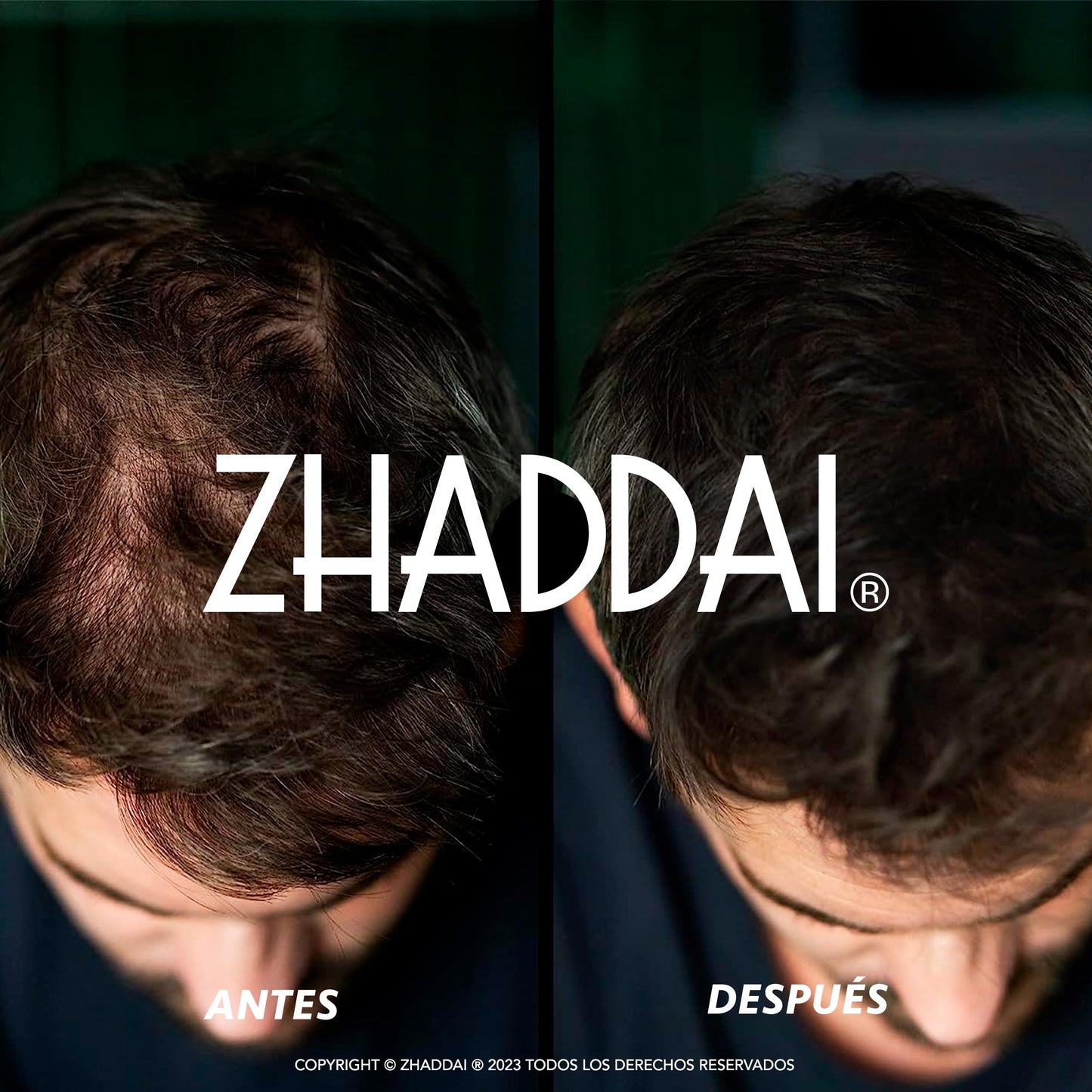 Fibras Capilares ZHADDAI® - 100% Natural. Cubre calvicie, disimula alopecia y densifica cabello. Aporta volumen y textura. ¡Voluminizador Instantáneo!
