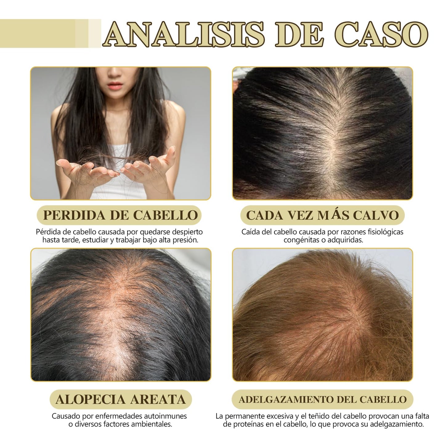 Conjunto Orgánico de Aceite de Romero para el Crecimiento del Cabello - Reducción de la Caída y Protección de la Salud Capilar. Tratamiento Natural para Estimular el Crecimiento y Fortalecer el Pelo. ¡Atrévete a Lucir una Melena Sana y Radiante!