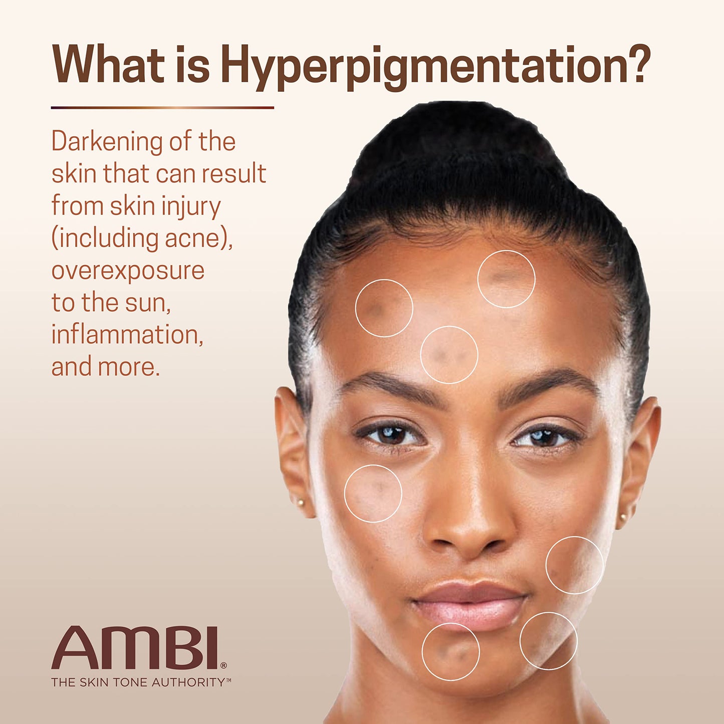 Suero Decolorante Uniforme y Transparente AMBI Reminol - ¡Ilumina tu piel!