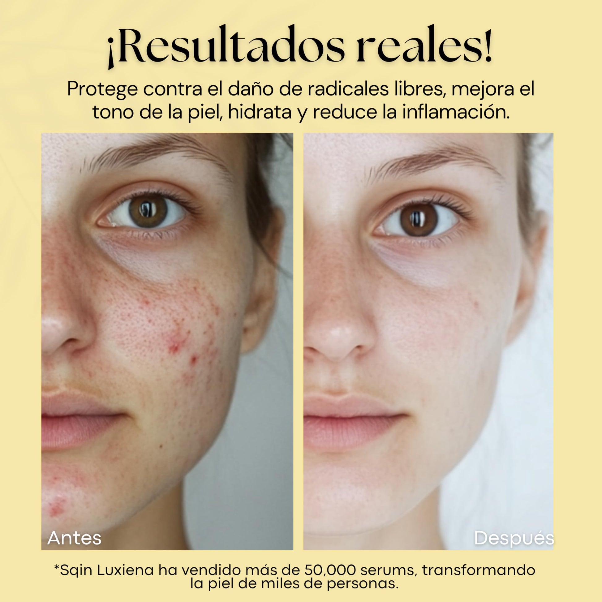 Sqin Luxiena Serum Baba de Caracol Coreano, Mucina de Caracol 96%, Repara e Hidrata la piel, Skincare Coreano, Snail Mucin, 100 ml.