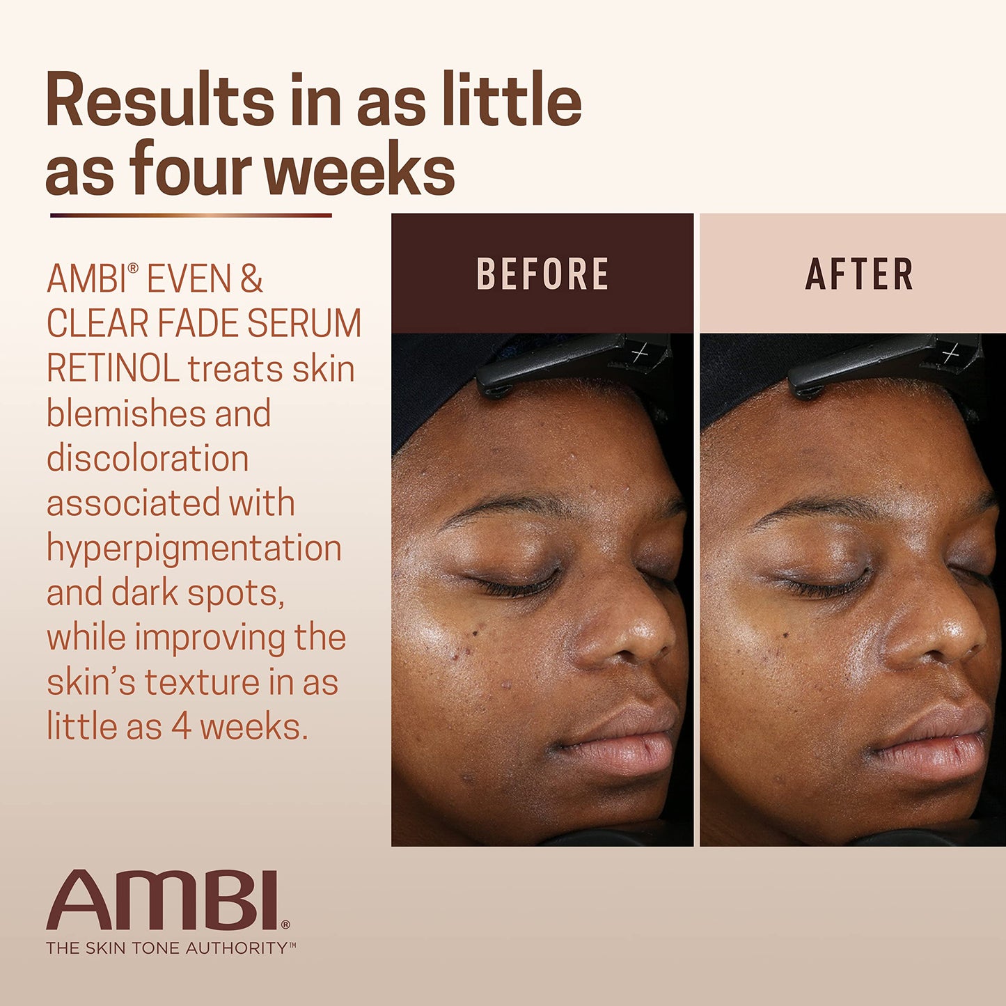 Suero Decolorante Uniforme y Transparente AMBI Reminol - ¡Ilumina tu piel!
