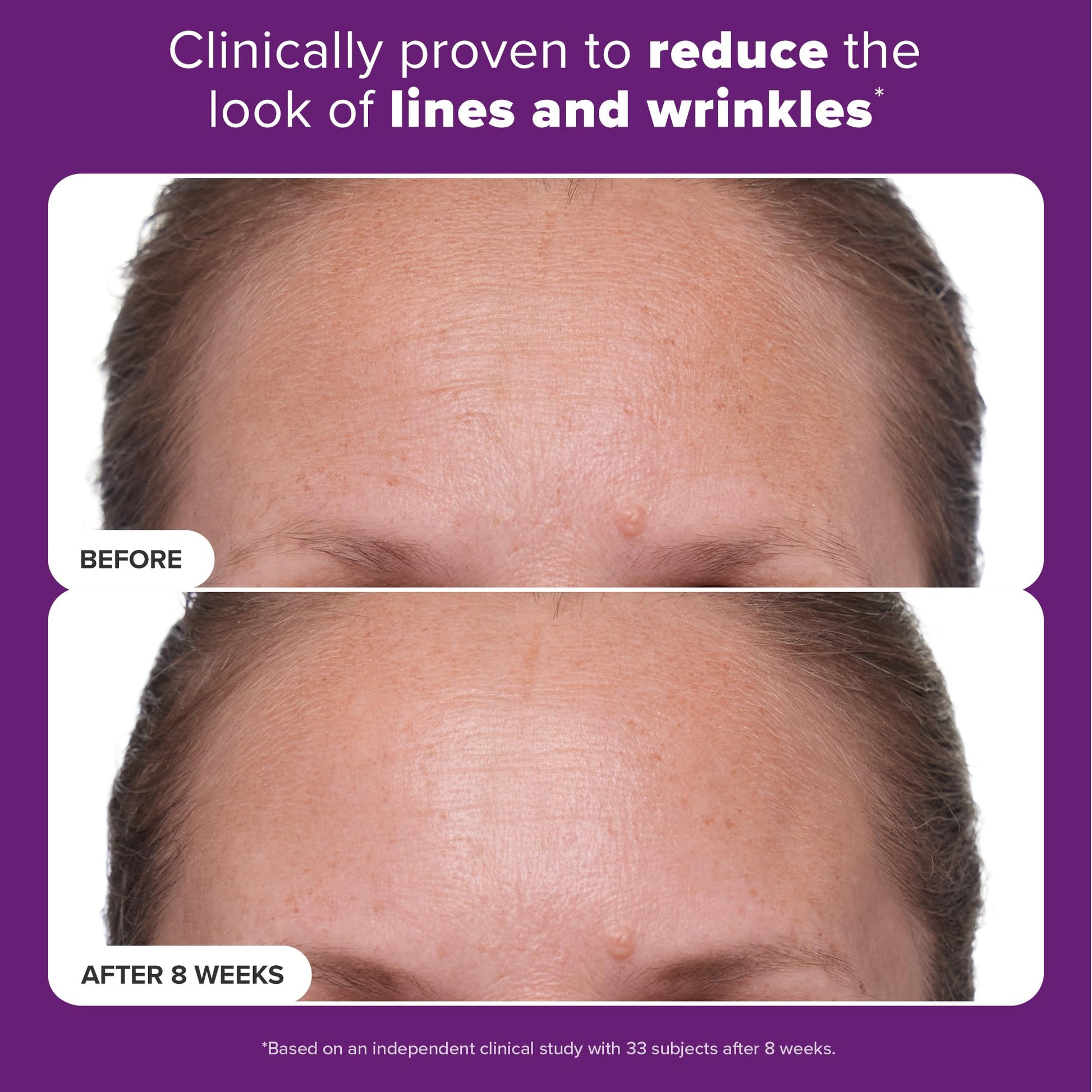 Tratamiento con Retinol 1% Paula's Choice Peptides y Vitamina C 1 oz para Arrugas Profundas