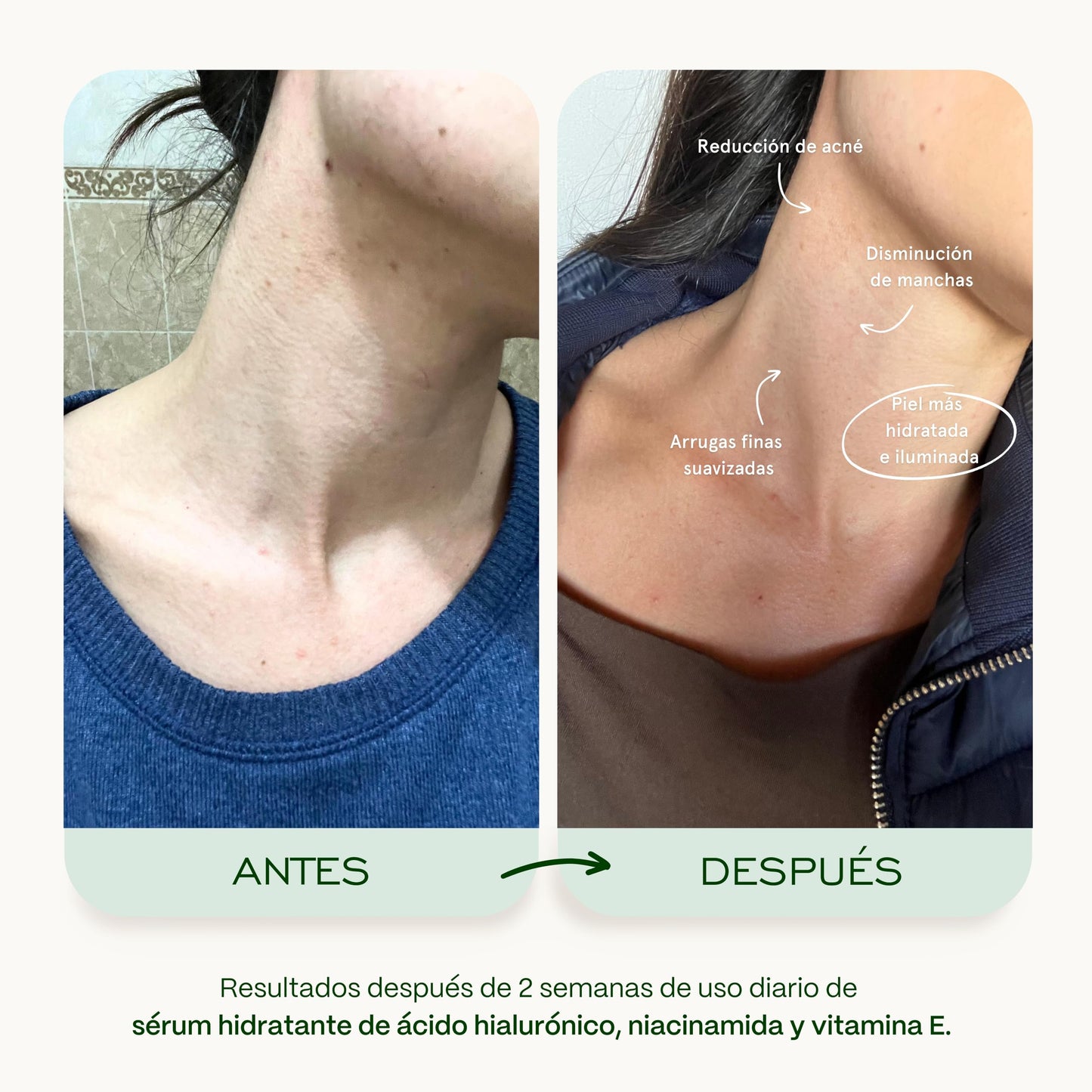 Skenties Sérum Hidratante con Ácido Hialurónico, Niacinamida y Vitamina E - Controla Grasa, Reduce Poros e Imperfecciones - FPS 15 - Hidratación Profunda - 30 ml