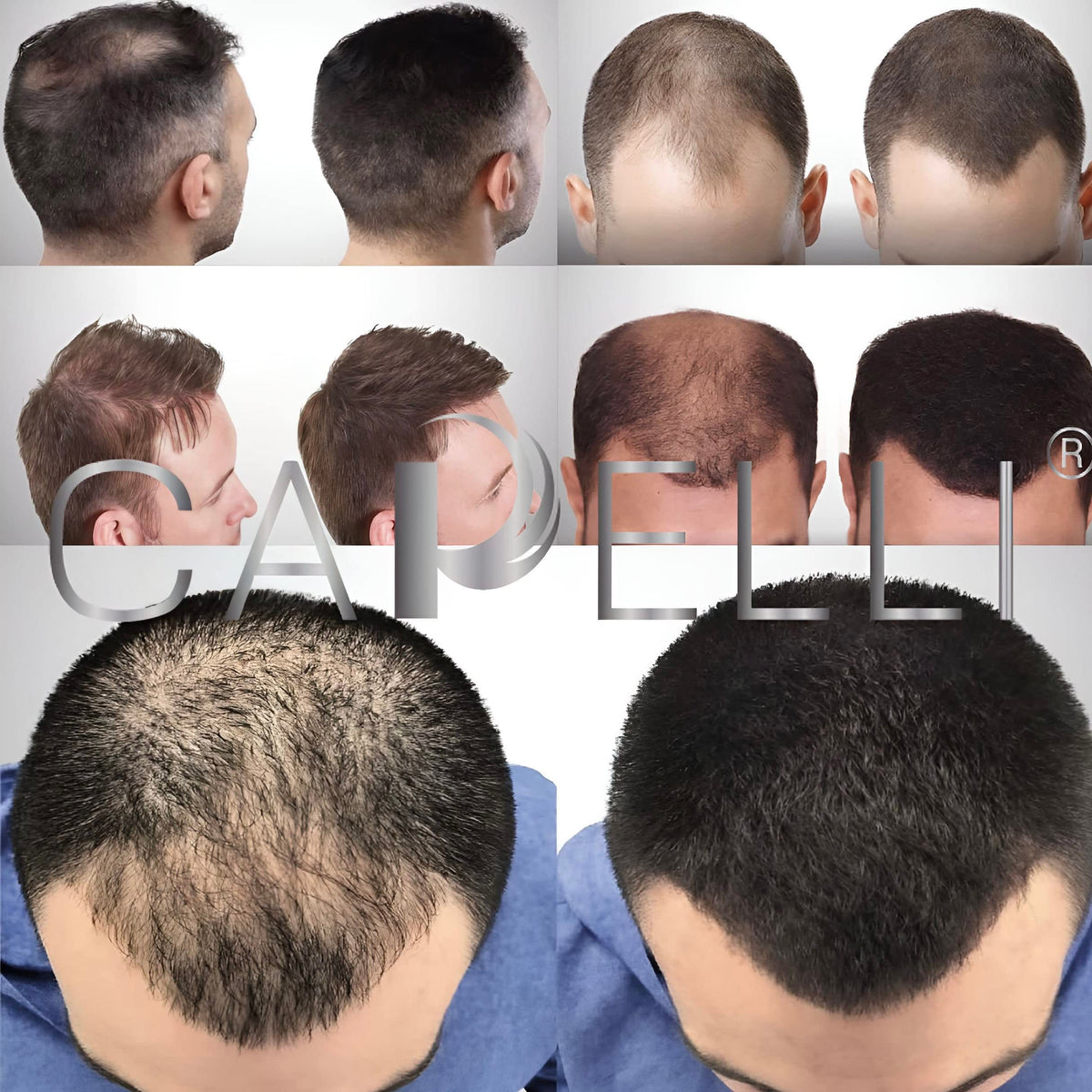 Fibras Capilares Capelli Castaño Claro Polvo para Calvicie y Alopecia