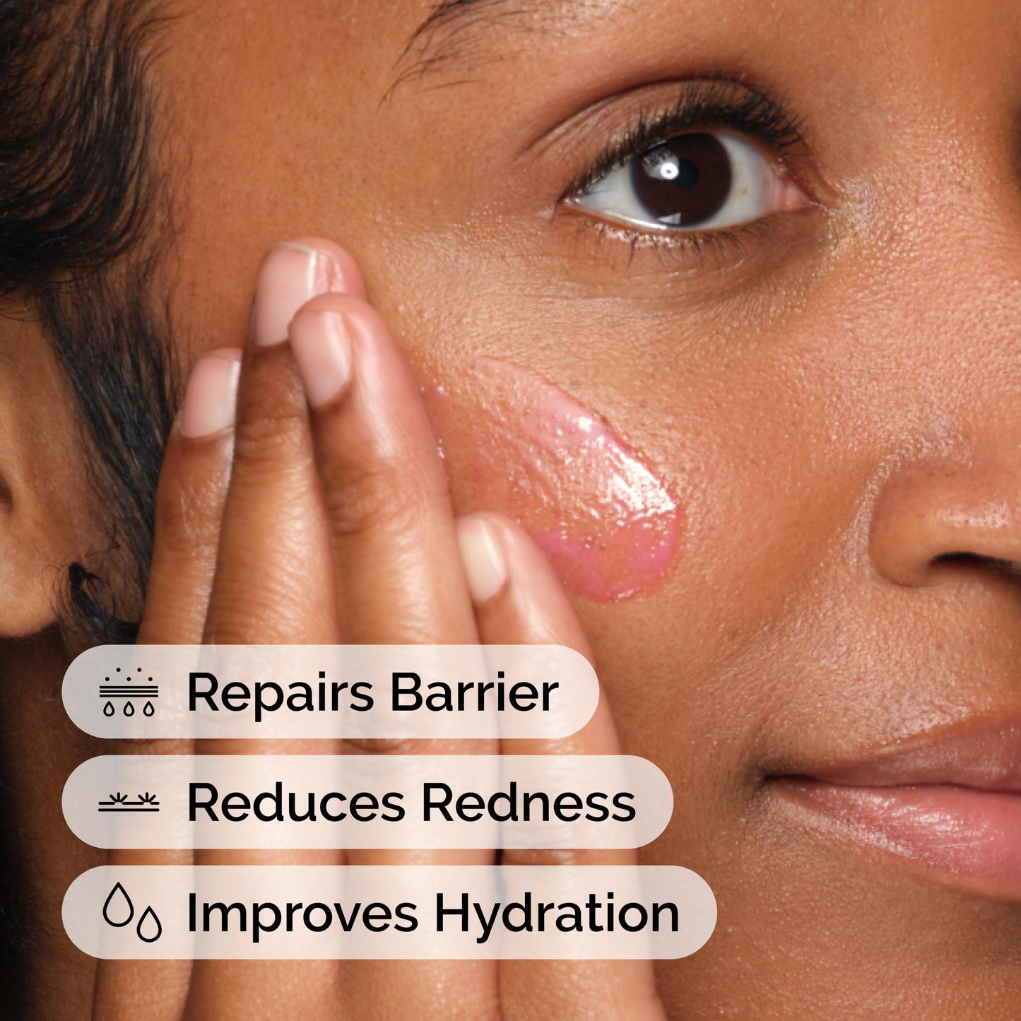the ordinary soothing & barrier support serum