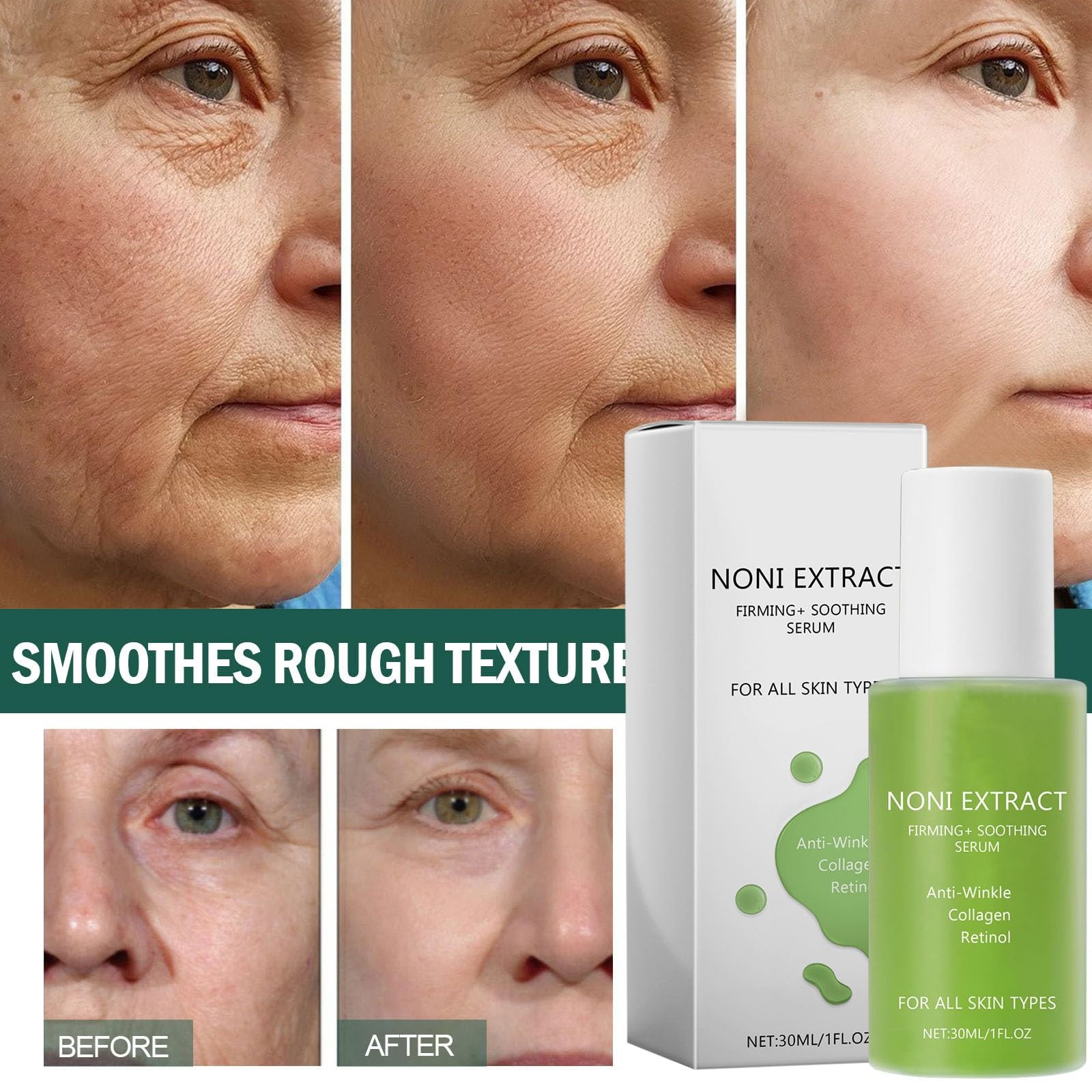 Serum Facial de Extracto de Noni para Rejuvenecer y Suavizar la Piel - Pack de 3, 30ml