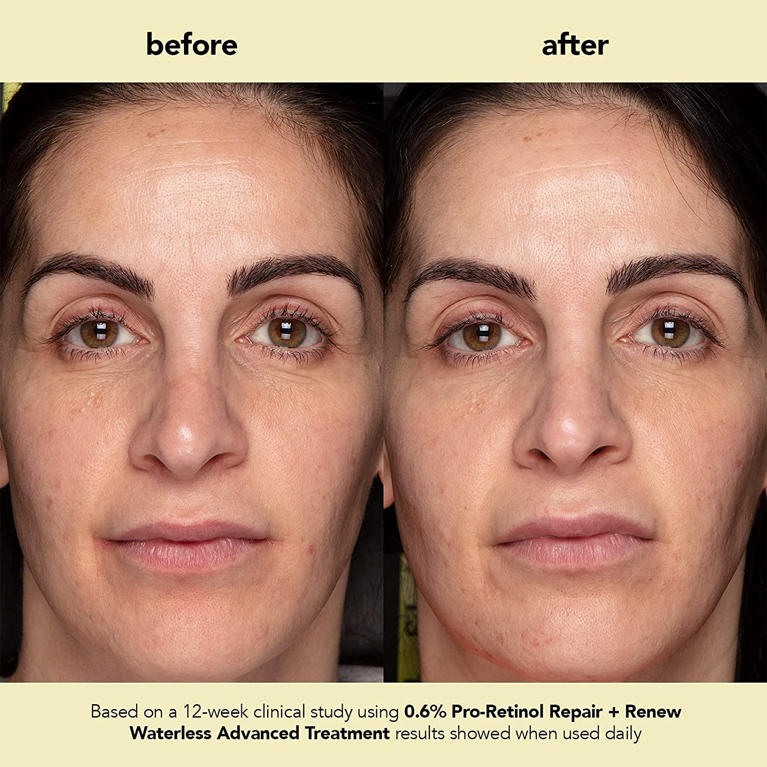 Tratamiento Avanzado boscia Pro-Retinol Sin Agua Anti-Arrugas y Antienvejecimiento para Hiperpigmentación