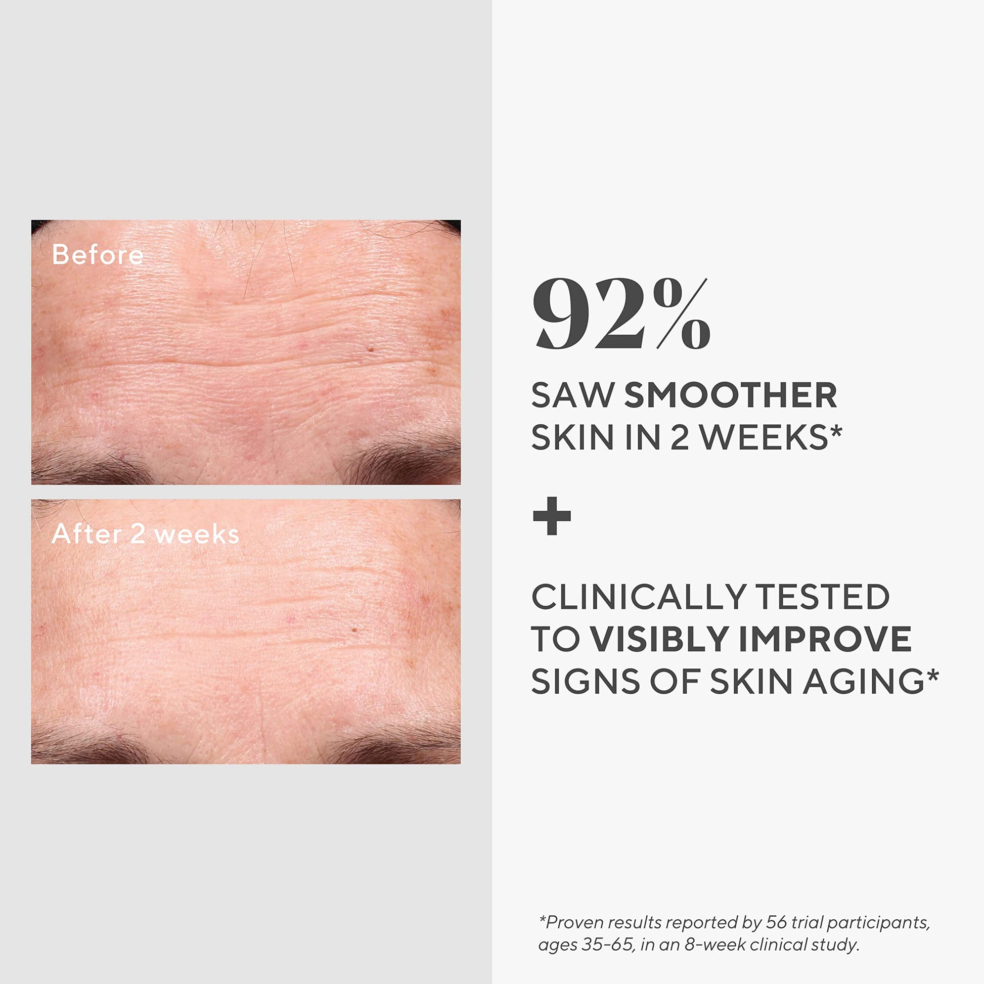 Murad Youth renewal retinol suero, 30 ml