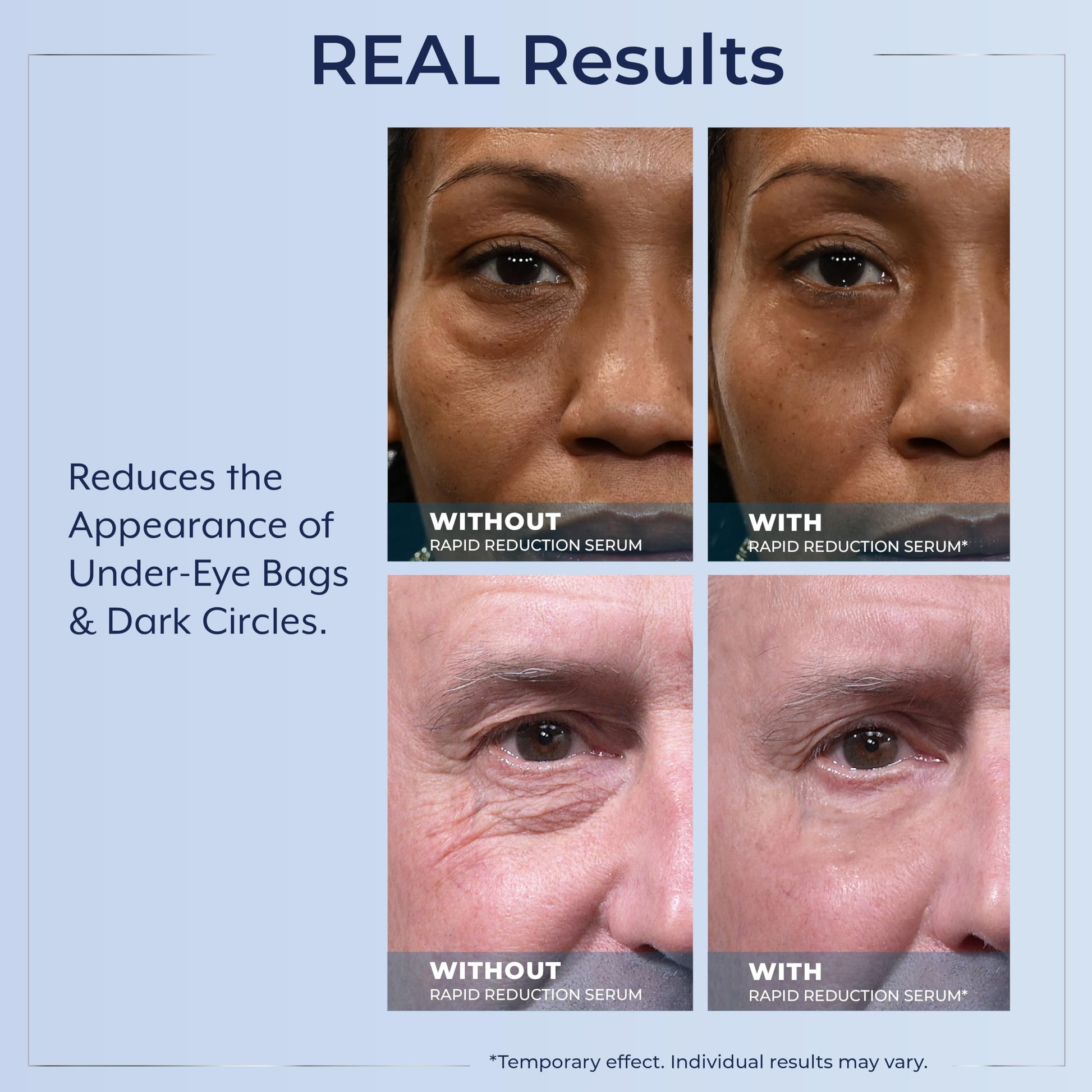 Suero Anti-Envejecimiento Plexaderm Avanzado con Minerales de Arcilla para Piel Rejuvenecida