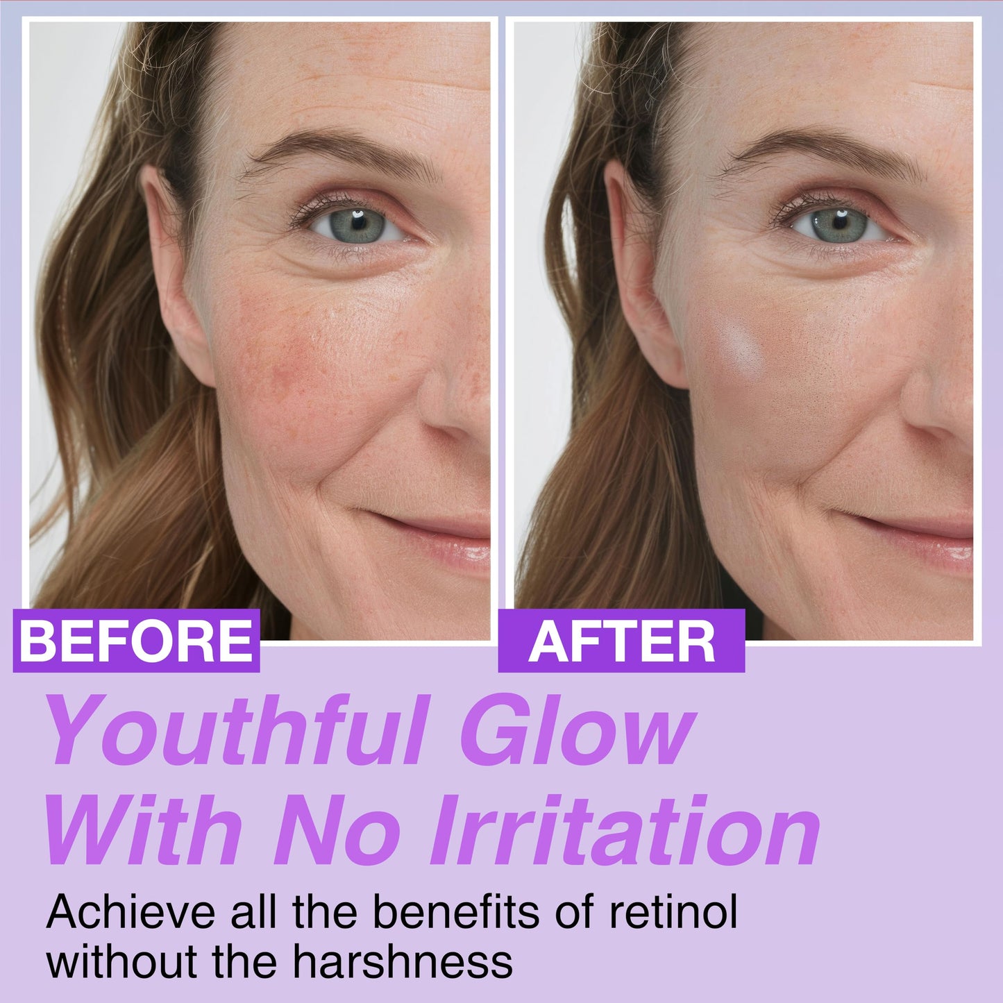 Concentrado de bakuchiol coreano en suero, 30 000 ppm, alternativa al retinol de alta potencia, reducción de arrugas, reafirmación y suavizado de la piel, antienvejecimiento, piel sensible, vegano y