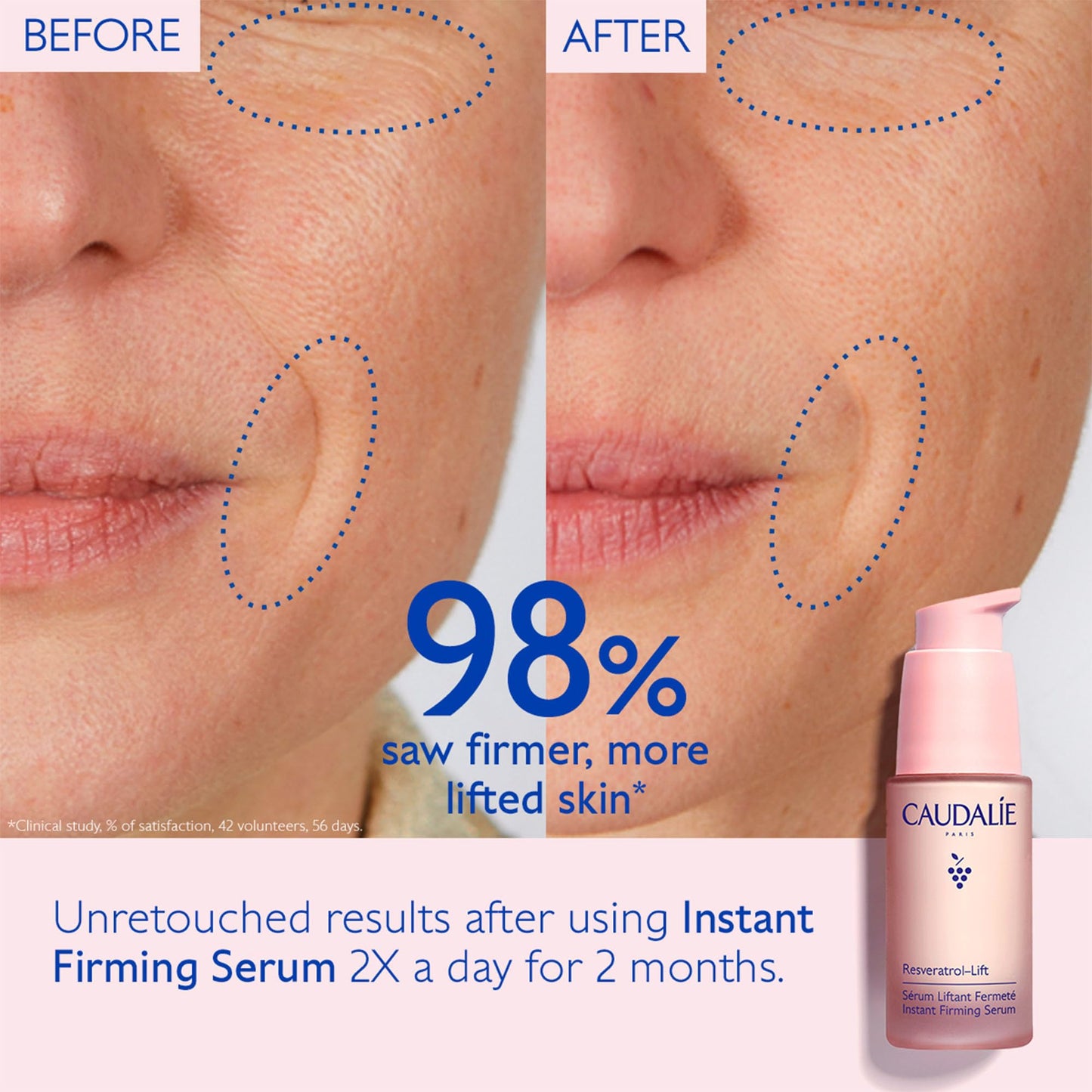 Caudalie Resveratrol Lift Serum Reafirmante Instantáneo Alternativa al Retinol