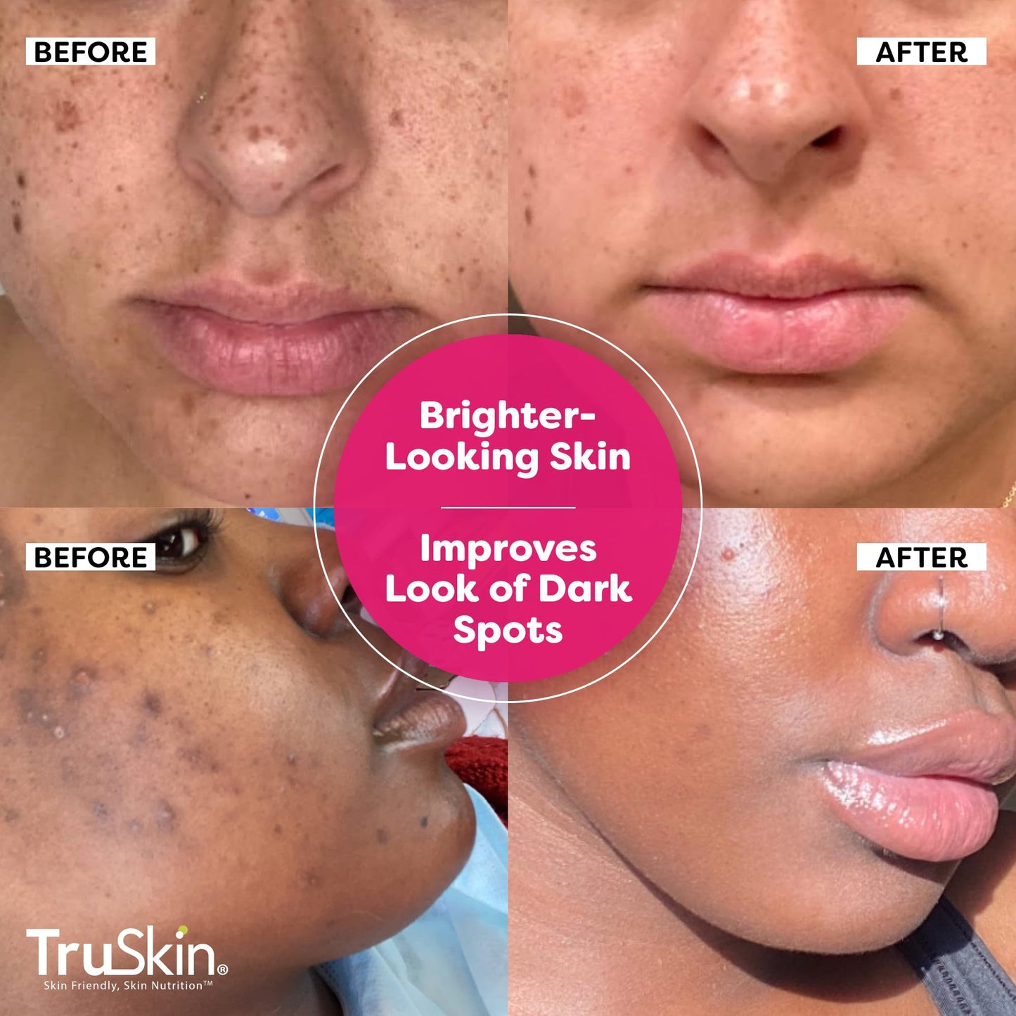 Vitamin C-Plus Super Serum, Anti Aging Anti-Wrinkle Facial Serum with Niacinamide, Retinol, Hyaluronic Acid, and Salicylic Acid