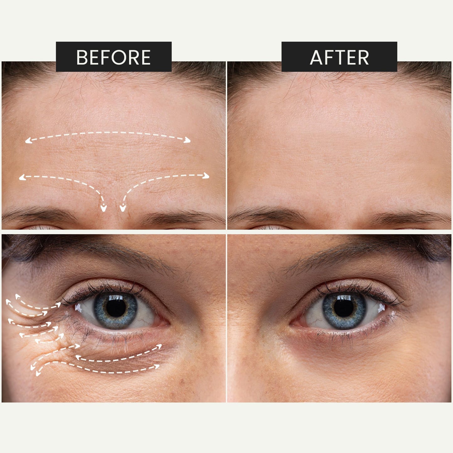 KUMIKO Matcha Intense Recovery - Suero Facial Hidratante con Proteoglicanos, Antienvejecimiento y Corrector de Arrugas - Reduce las Bolsas en el Rostro las Líneas Finas - Cuidado de la Piel, 15 Vials