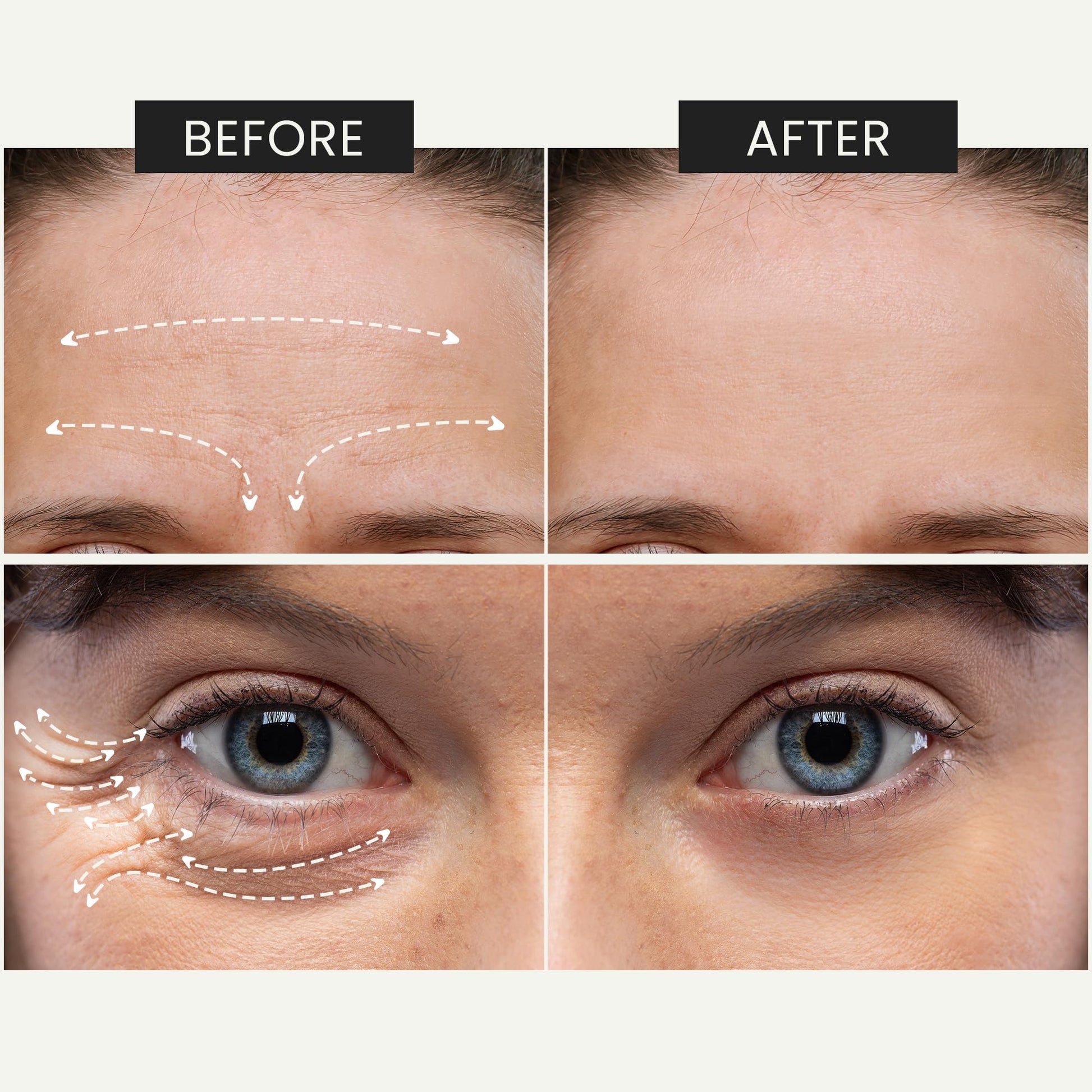 KUMIKO Matcha Intense Recovery - Suero Facial Hidratante con Proteoglicanos, Antienvejecimiento y Corrector de Arrugas - Reduce las Bolsas en el Rostro las Líneas Finas - Cuidado de la Piel, 15 Vials