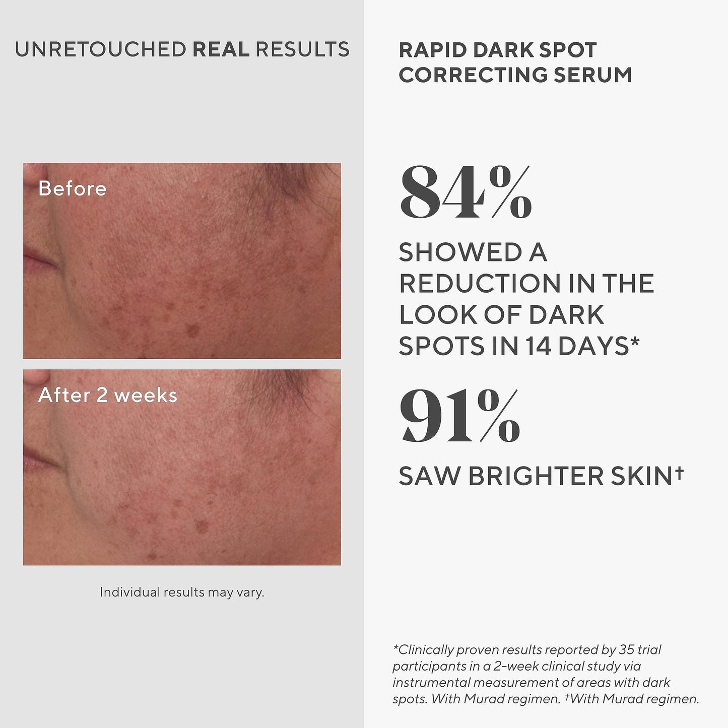 Murad - Rapid Dark Spot Correcting Serum - 30ml, 15348, 03 kilograms, 30 mililitro, 1