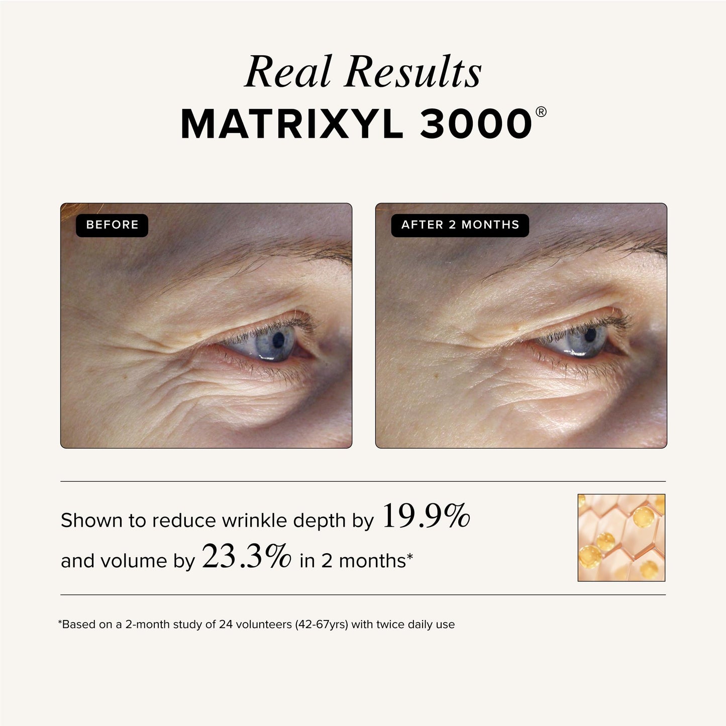 MATRIXYL 3000 + ARGIRELINE Peptide + Vitamin C 4 oz Serum with Organic Hyaluronic Acid - Reduce Sun Spots, Wrinkles, Our Most Powerful Triple Combination - ASTERWOOD NATURALS - Bottle