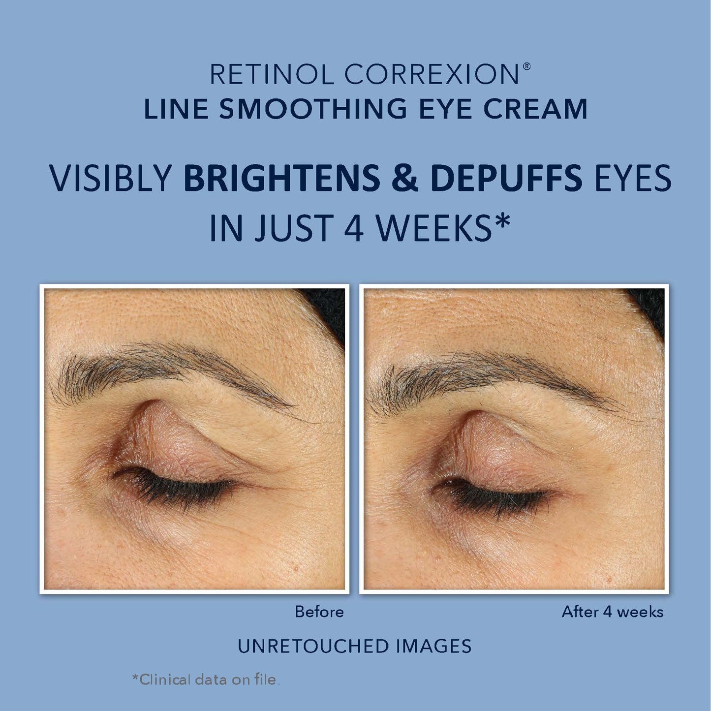 RoC Retinol Correxion Deep Wrinkle Repair Pack
