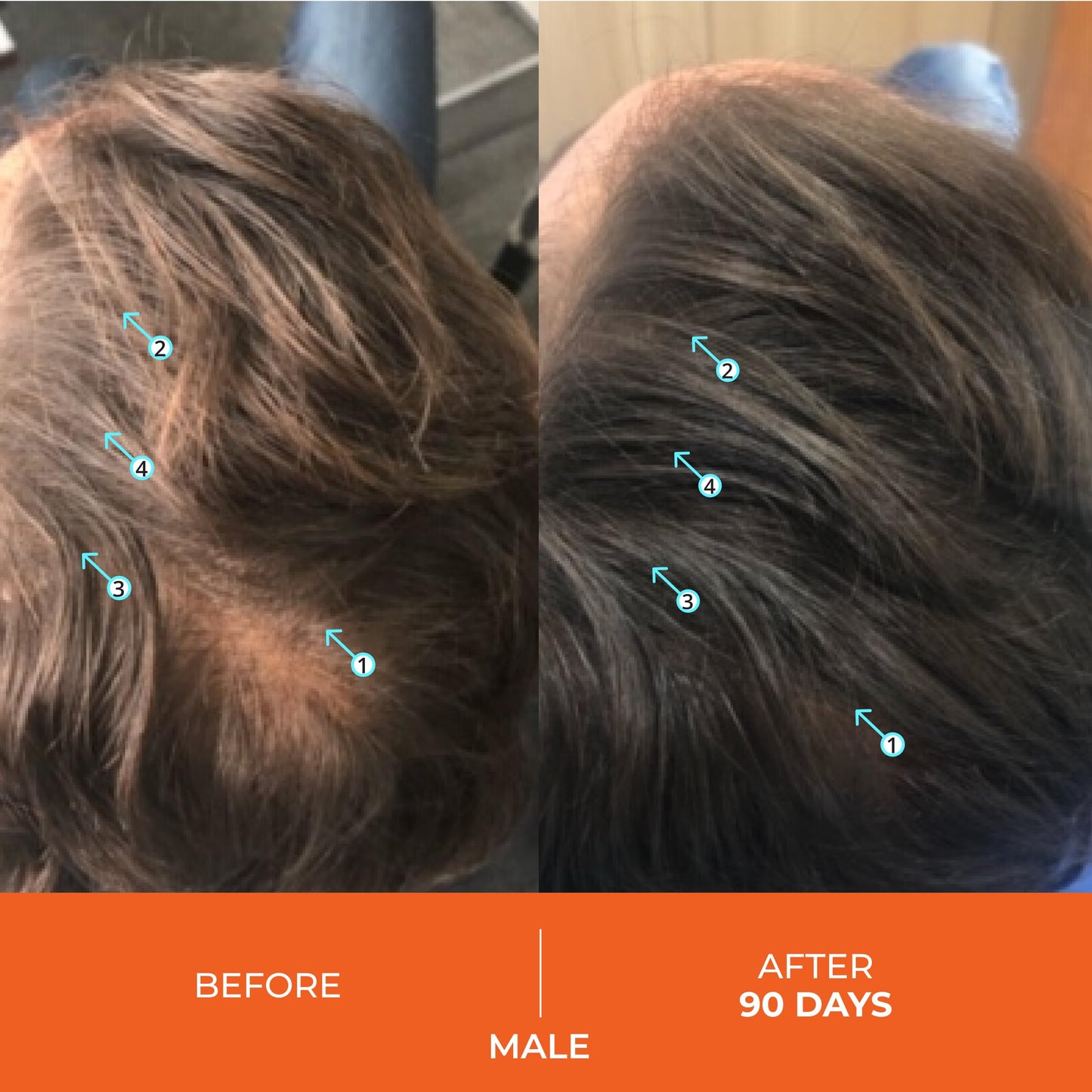 DS Laboratories | Revita® Shampoo para la Densidad Capilar
