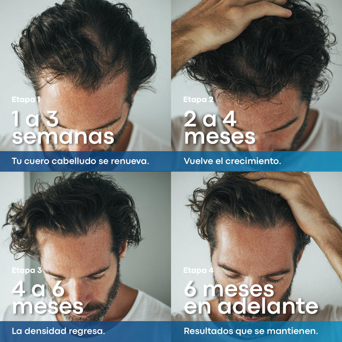 Spray Anticaída Anacastel Minoxidil 5% 60 ml