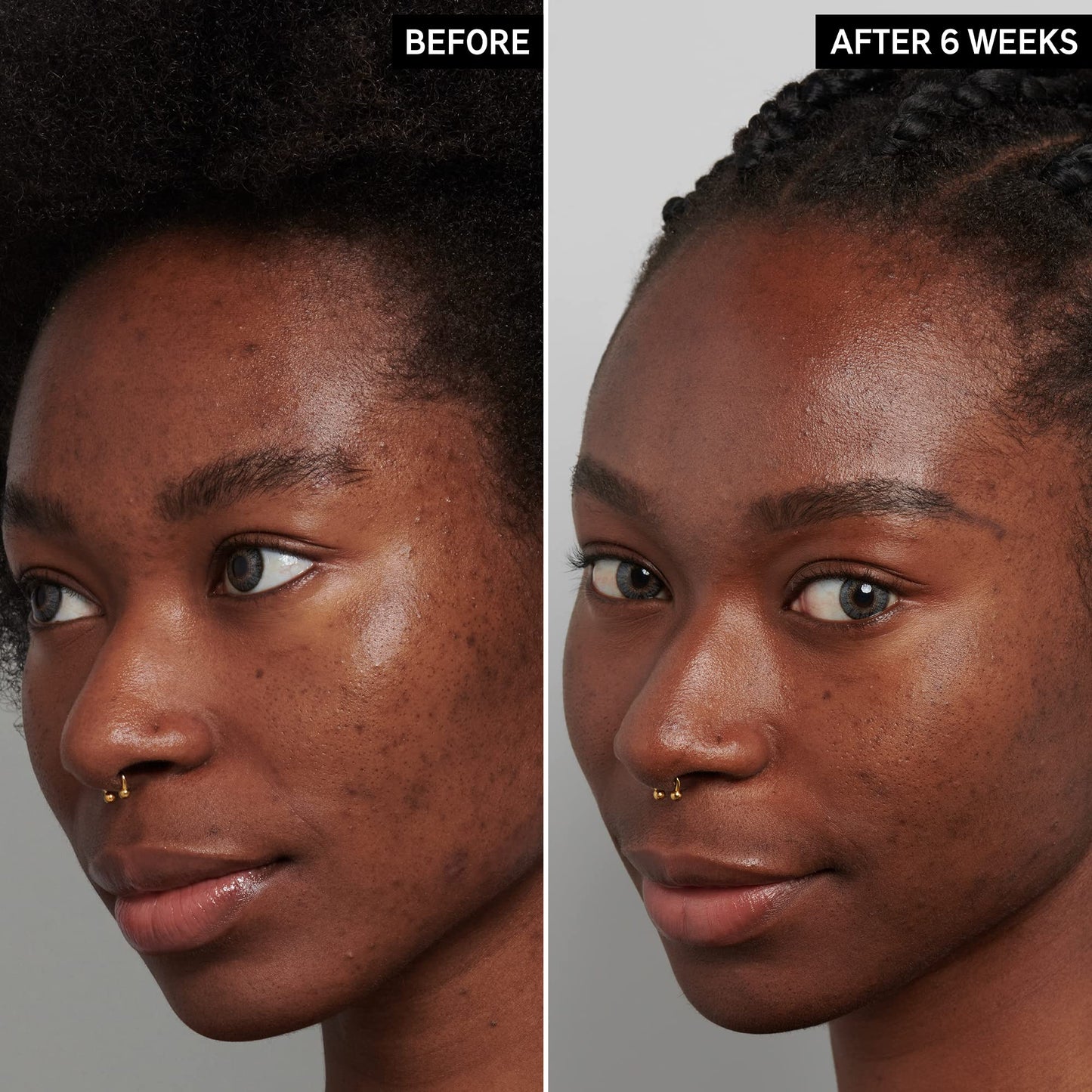 Suero INKEY List Ácido Tranexámico Reducción Decoloración y Manchas Oscuras 1 fl oz