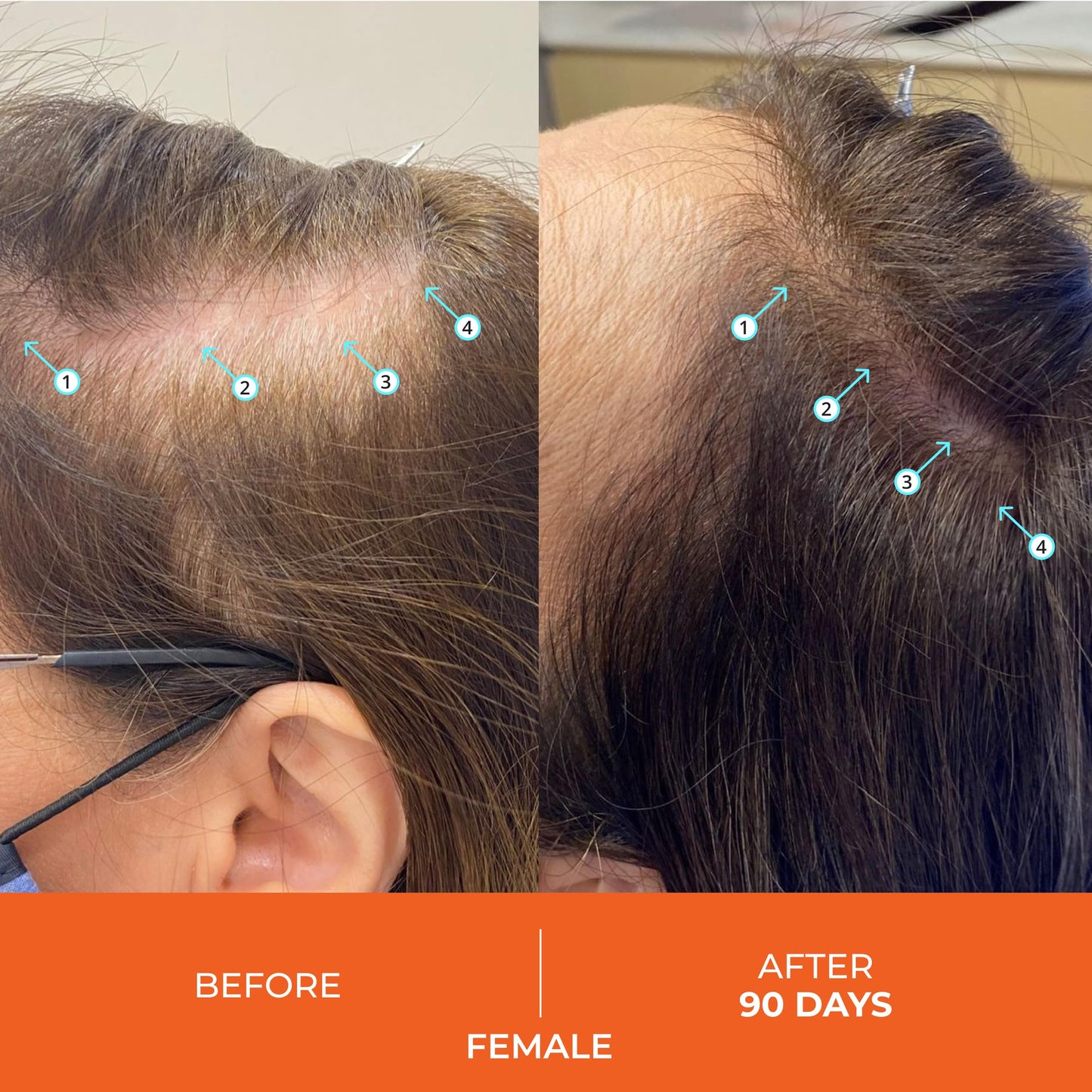 DS Laboratories | Revita® Shampoo para la Densidad Capilar