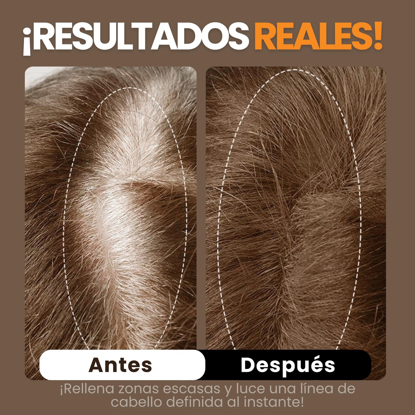 Henrys Polvo para Retocar Raíces Castaño Medio, Rellena Zonas Escasas, Define la Línea del Cabello y Cubre el Crecimiento de Raíces al Instante y en Cualquier Momento, Fibras Capilares Hairline Powder. Calvicie, Caida de Cabello o falta de Volumen para Mu