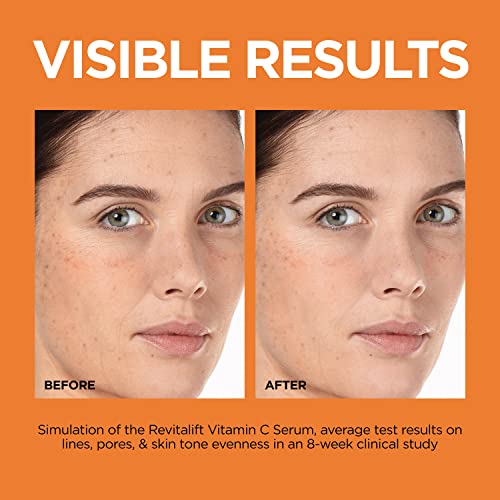 L'Oreal Paris Revitalift Vitamin C Serum with Vitamin E & Salicylic Acid, Moisturizing, Smoothing & Brightening, Non Greasy, Combats Early Signs of Aging + Sample