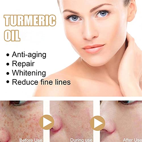 Serum Reparador de Manchas Oscuras de Cúrcuma - Tratamiento para Melasma - 2 Unidades - ¡Ilumina tu piel!