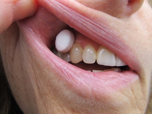 Caja de 40 Comprimidos XyliMelts sin Menta para Boca Seca