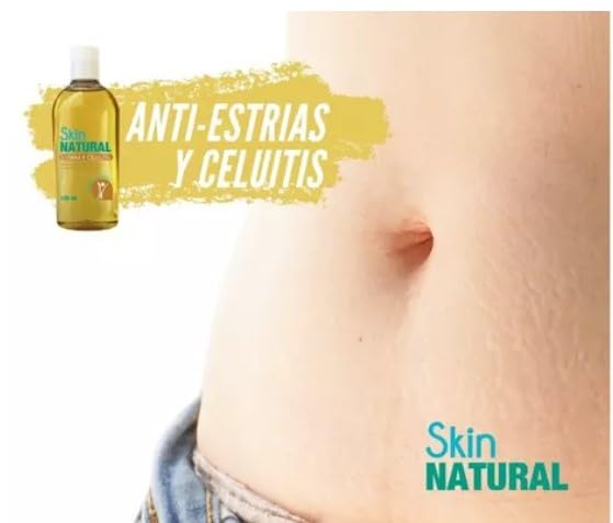 SKIN NATURAL - Aceite Corporal 250 ml - Previene, Atenua, y Disminuye, Estrías, Celulitis, Cicatrices, Imperfecciones e Impurezas - Oil 100% Natural, ideal para Embarazadas, Dietas, y Deportistas