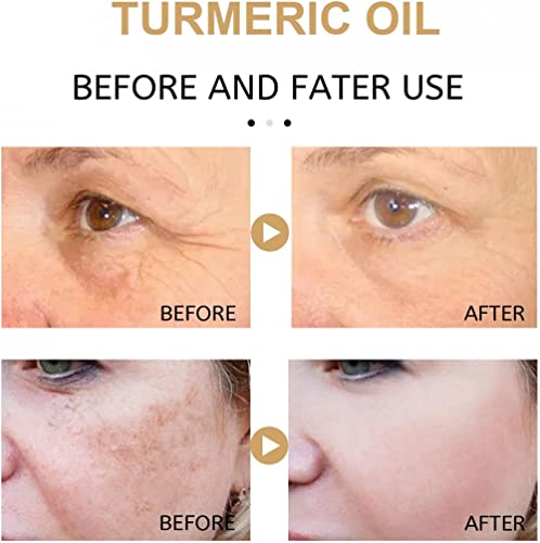 Serum Reparador de Manchas Oscuras de Cúrcuma - Tratamiento para Melasma - 2 Unidades - ¡Ilumina tu piel!