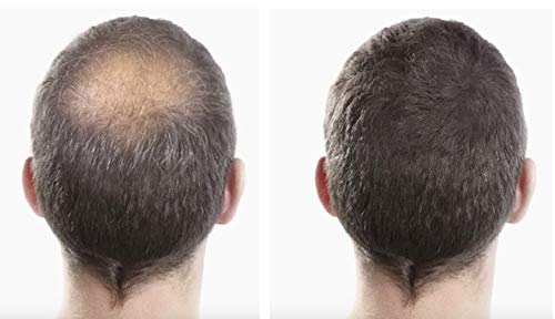 Fibras Capilares Capelli Castaño Claro Polvo para Calvicie y Alopecia