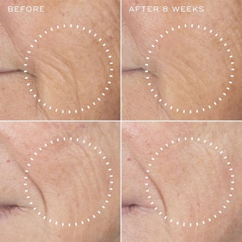 Medik8- Suero con 30% de péptidos: nuestro suero con péptidos para el rostro ofrece una fórmula potente, diseñada para brindar una experiencia antienvejecimiento sin igual. Este suero facial para muj
