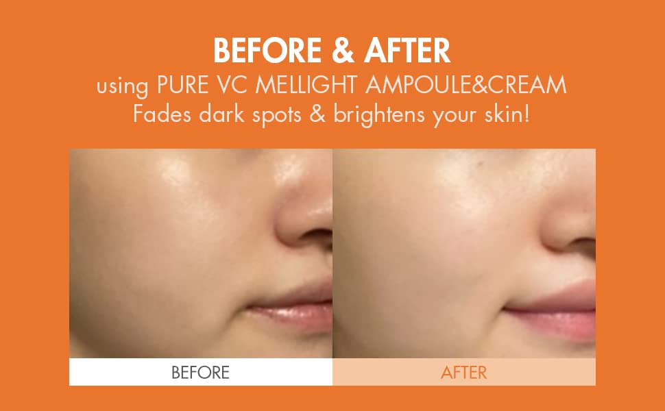 leegeehaam Dr.Ceuracle Pure Vitamin C Mellight CreamㅣTone-Up Serum for Face with Pure Vitamin CㅣAnti-Aging Moisturizer for Instant GlowㅣDark Spots, Wrinkles, & Sun Damaged SkinㅣParabens-Free