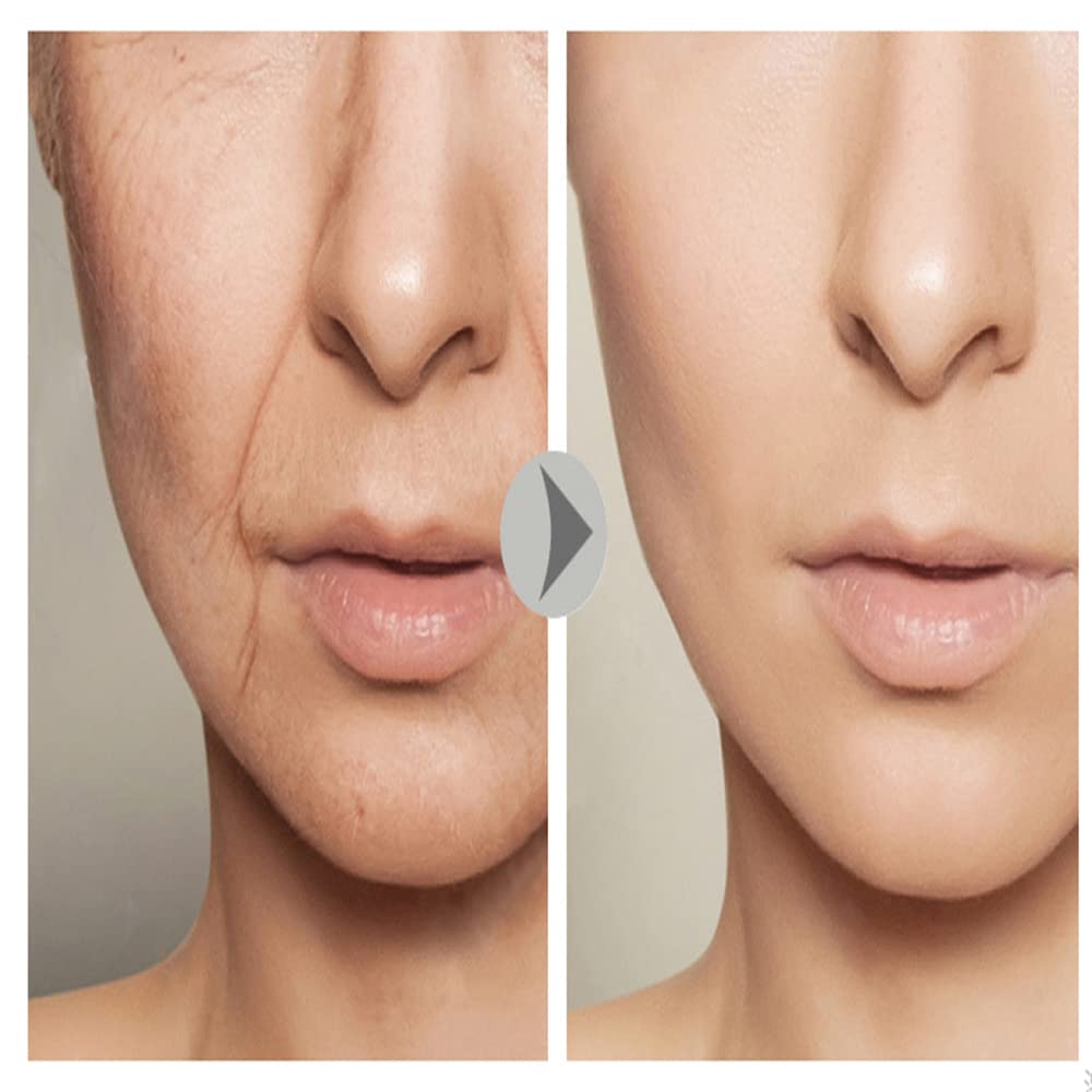 Esencia Facial de Ginseng Gold Polypeptide JitEm para Reducir Líneas Finas y Reafirmar Piel Flácida