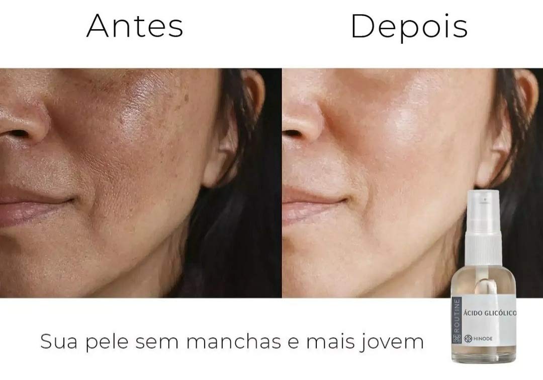 Suero Facial Ácido Glicólico Routine