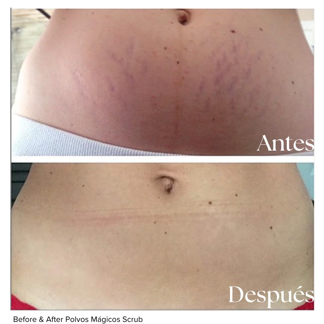 Exfoliante Corporal Polvos Mágicos Café Orgánico Aceite de Coco Anticelulitis y Estrías Bronceado Perfecto