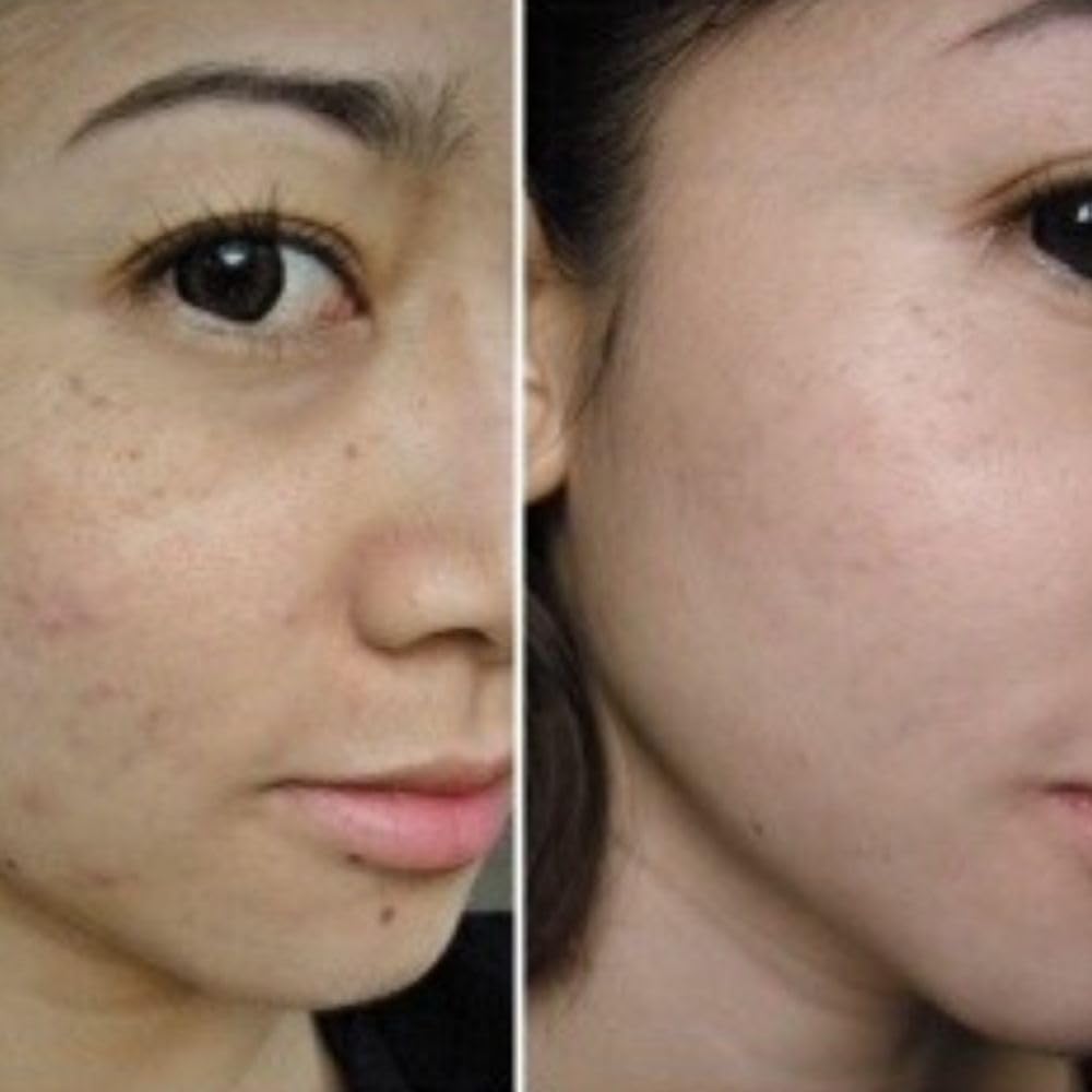 Multi Recovery Serum. Serum Aceite Facial. Thanaka + Oleico. Reduce la aparición de manchas oscuras. Rico en aminoácidos.
