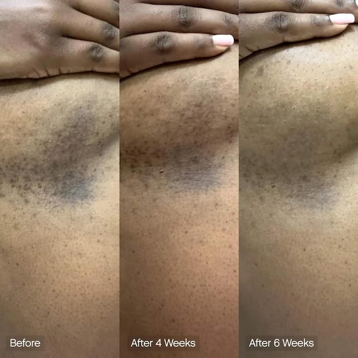 Topicals Jabón Limpiador Facial Y Corporal Faded | Ácido Kójico, Vitamina C Y Ácido Láctico | Hidrata | Vegano, Sin Perfume, Apto Para Pieles Sensibles (Paquete De 2)