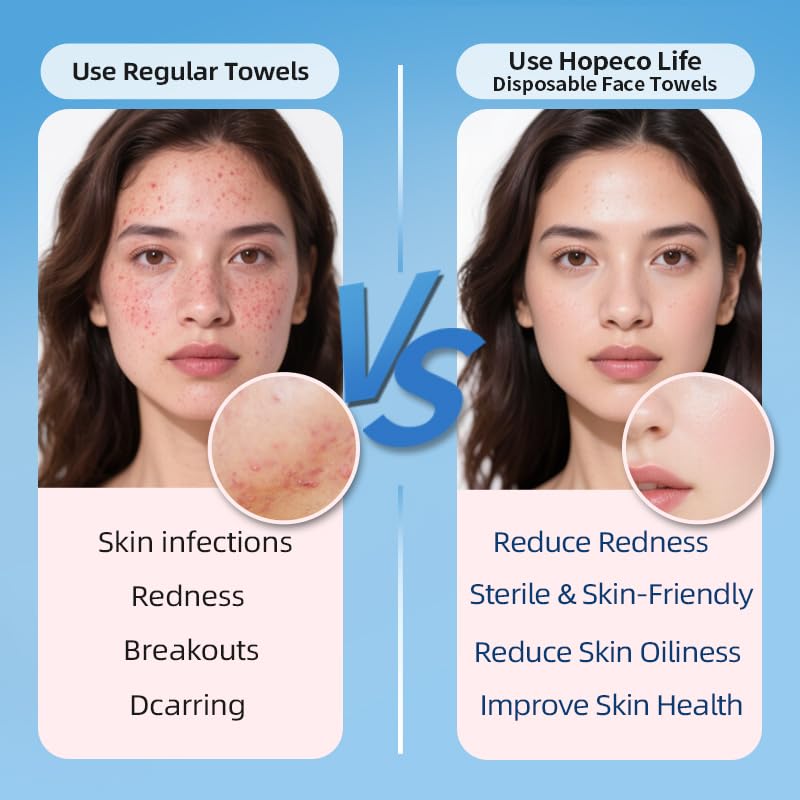 HOPECO LIFE Toallas faciales XXL